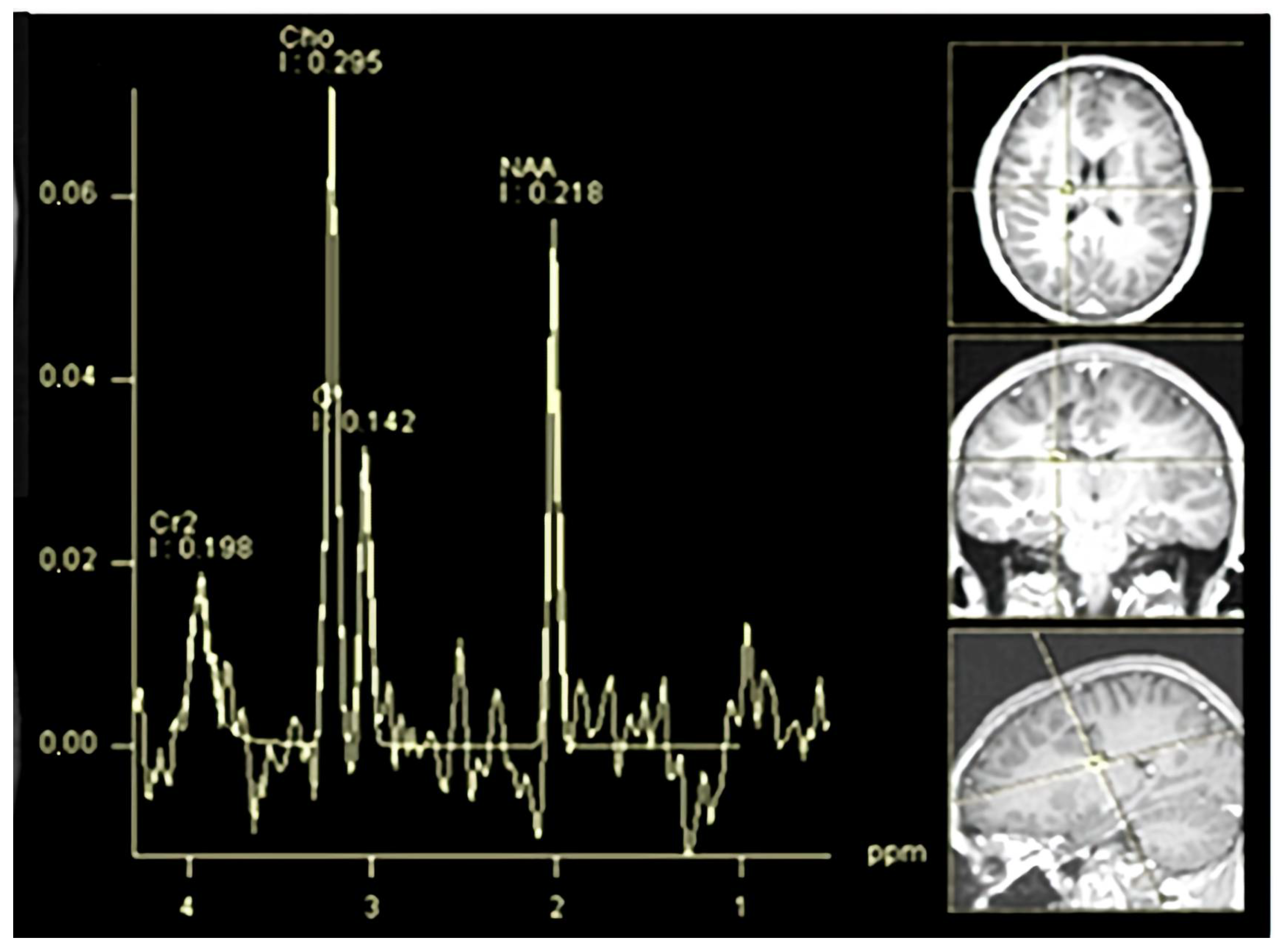 Children 12 00630 g006