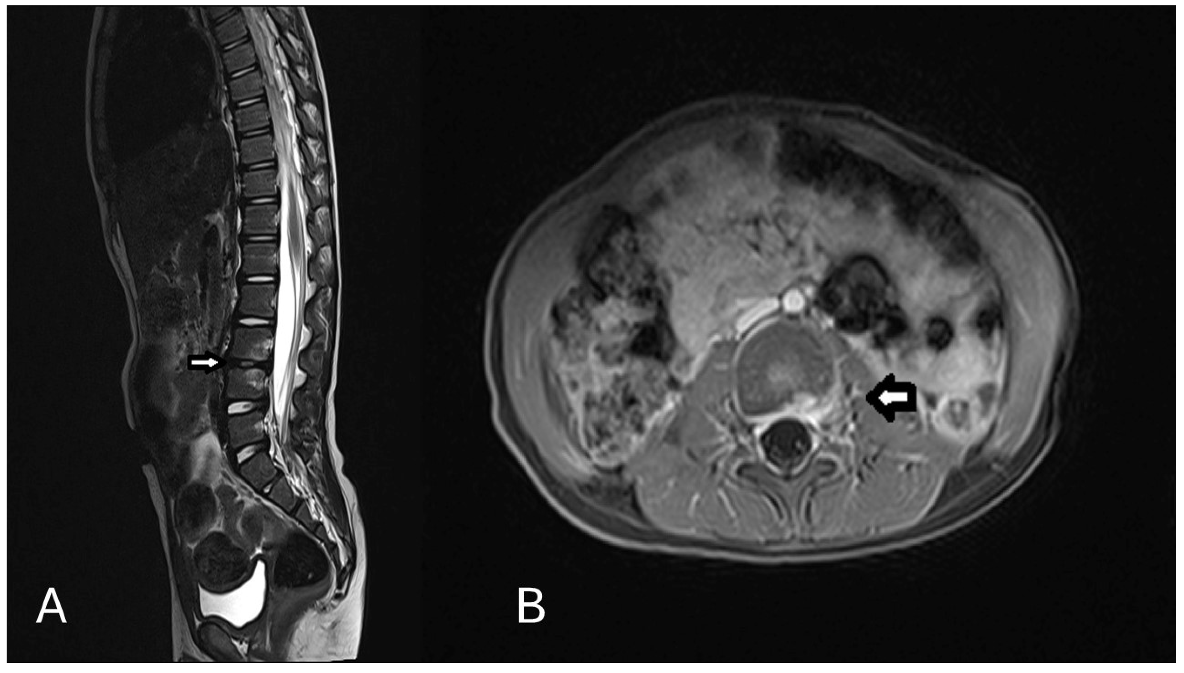 Children 12 00649 g002 Children 12 00649 g002