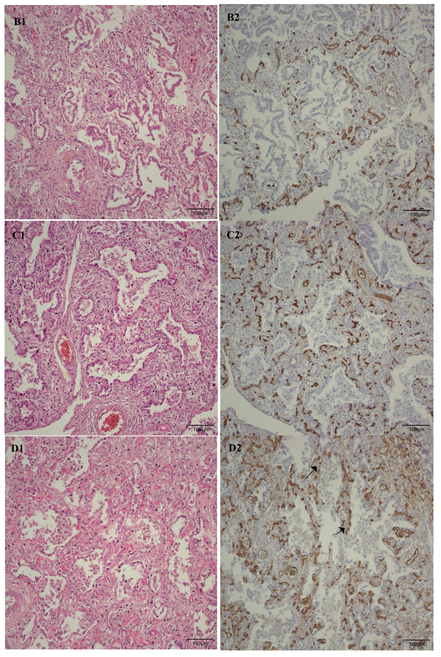 Children 12 00650 g007b