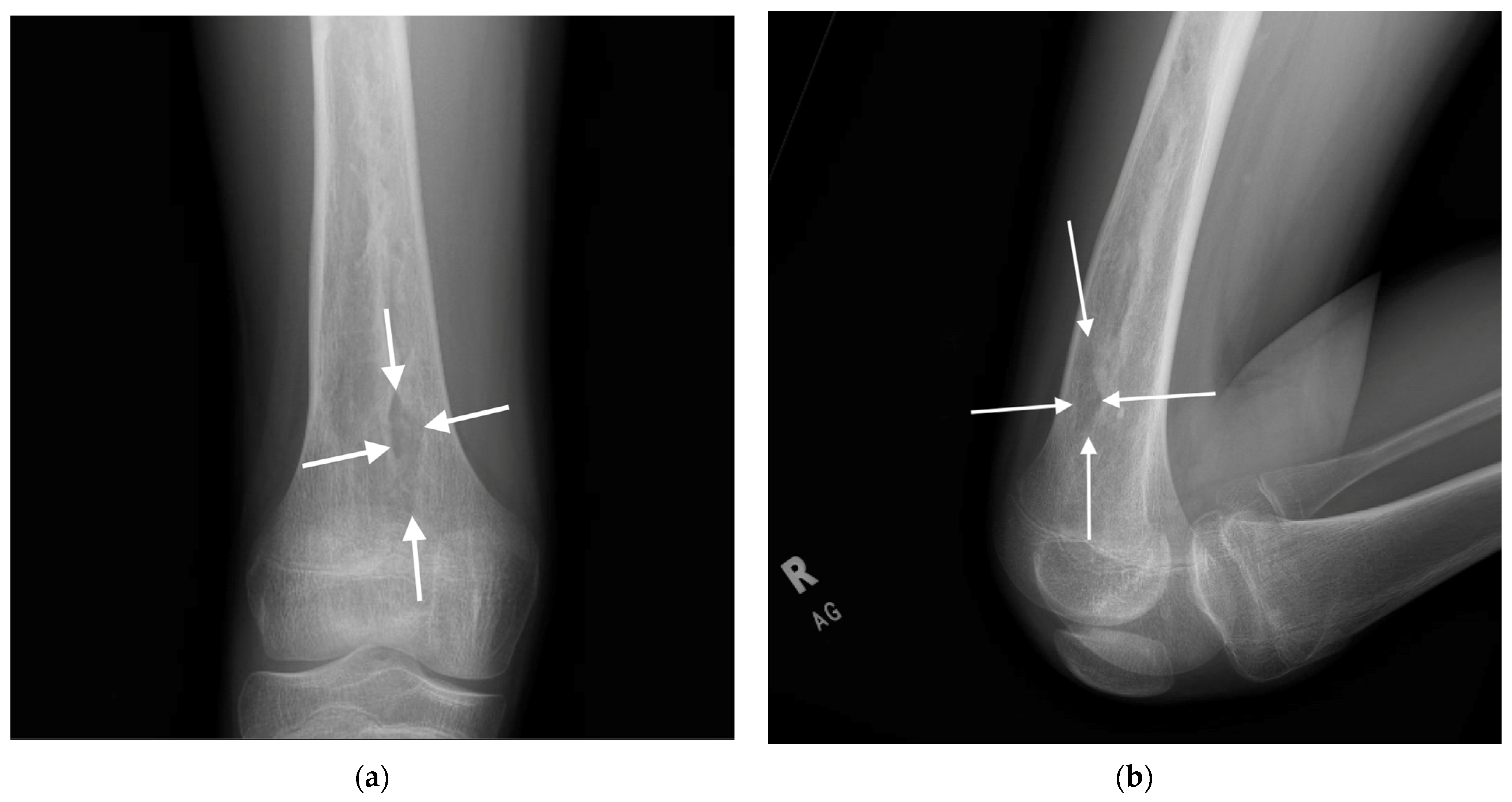 Children 12 00700 g003