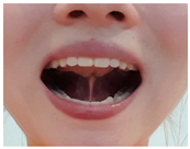 Children 12 00737 i009