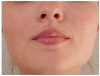 Children 12 00737 i010