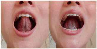 Children 12 00737 i011