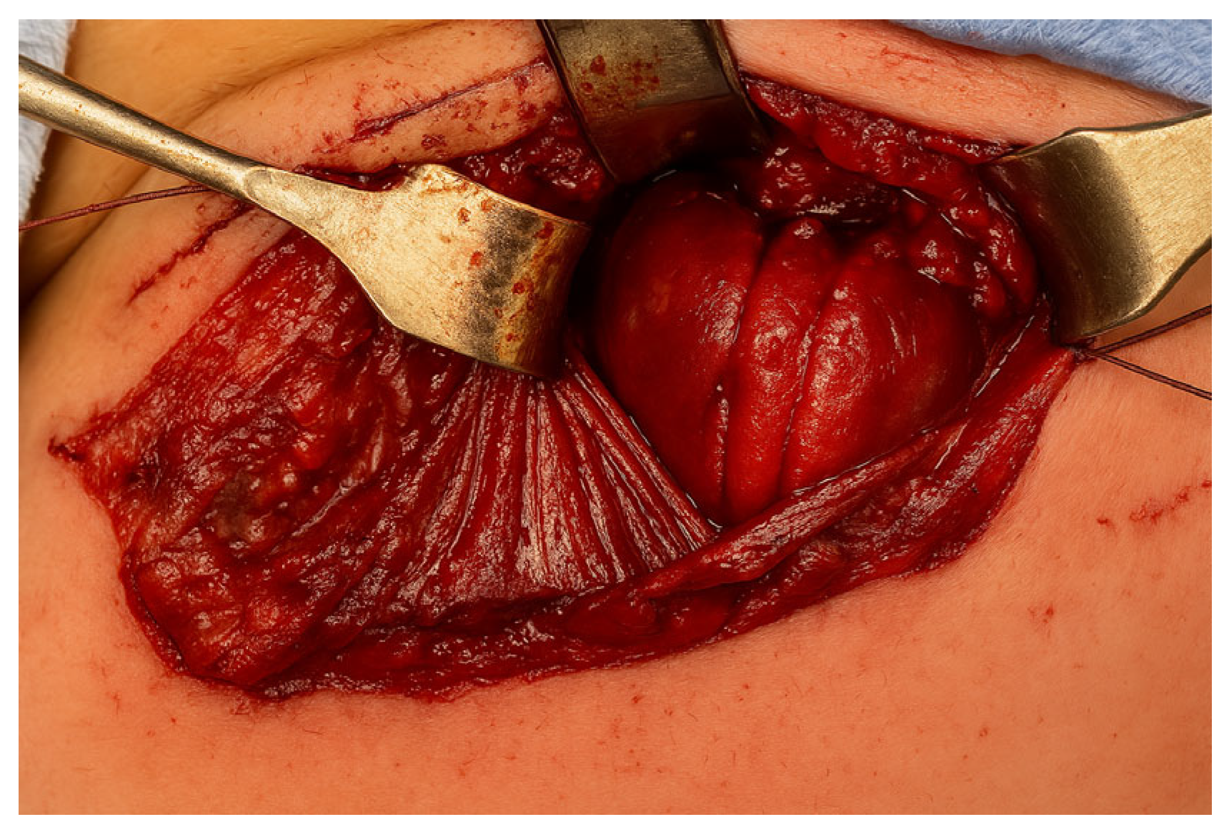 Children 12 00740 g004