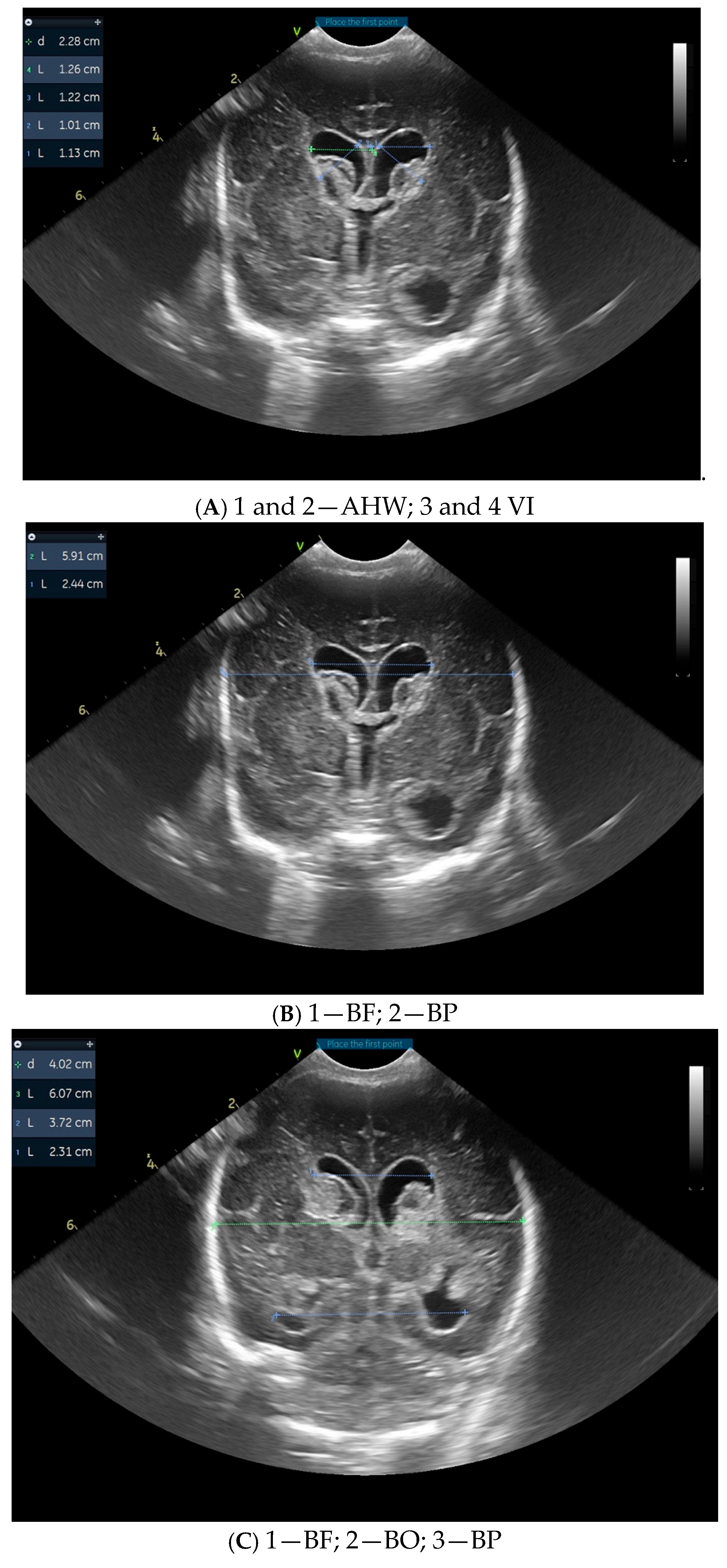 Children 12 00768 g001a