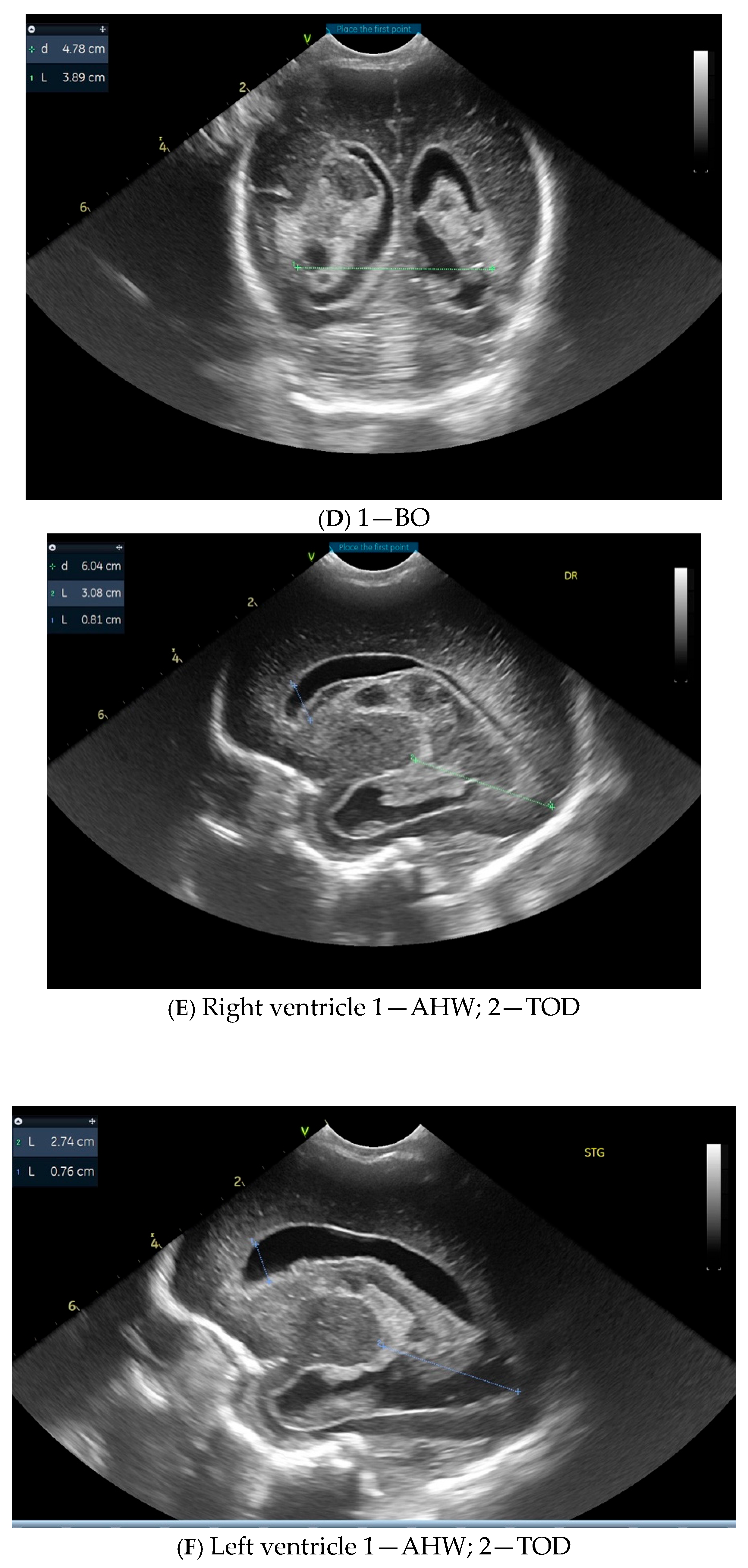 Children 12 00768 g001b