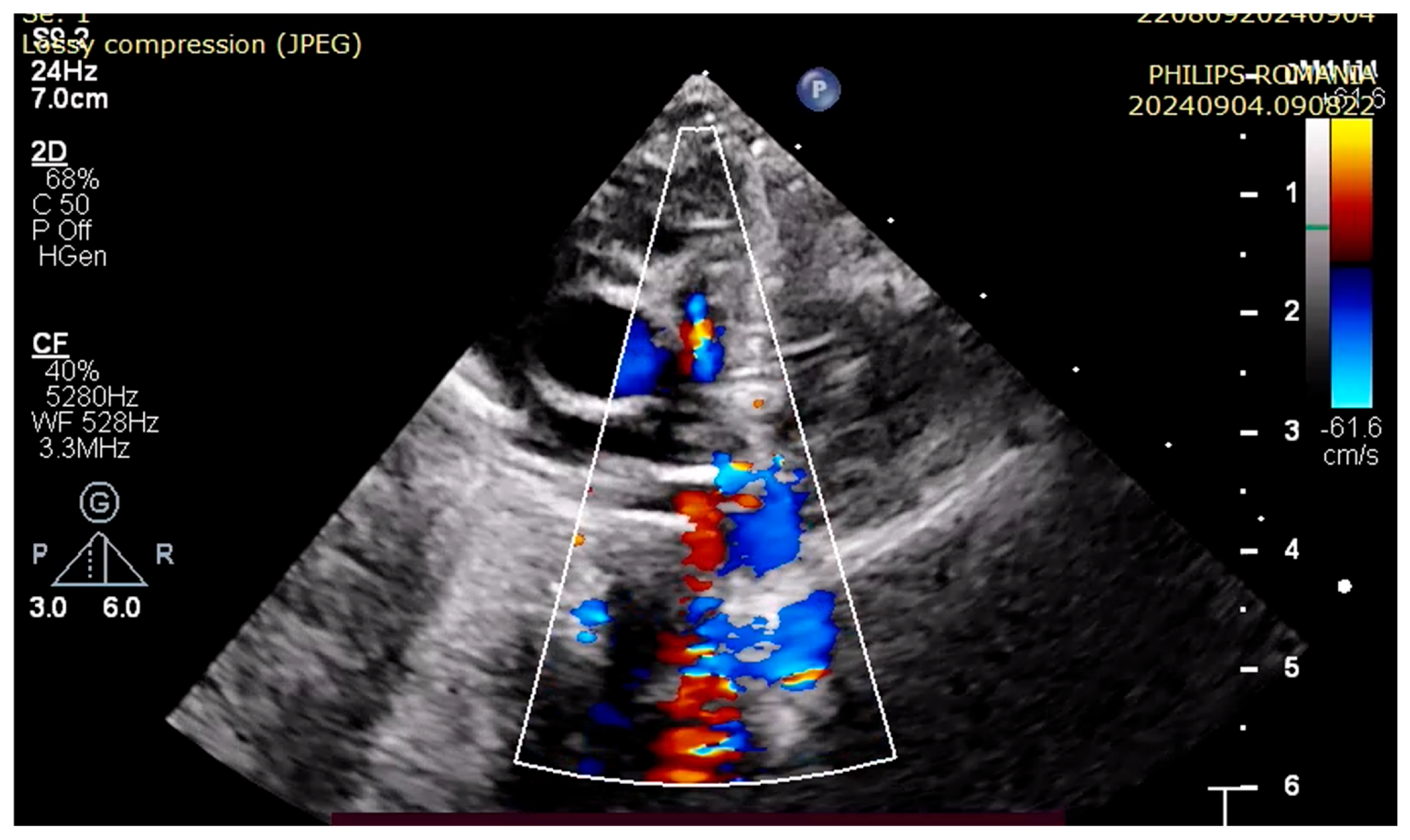 Children 12 00780 g001