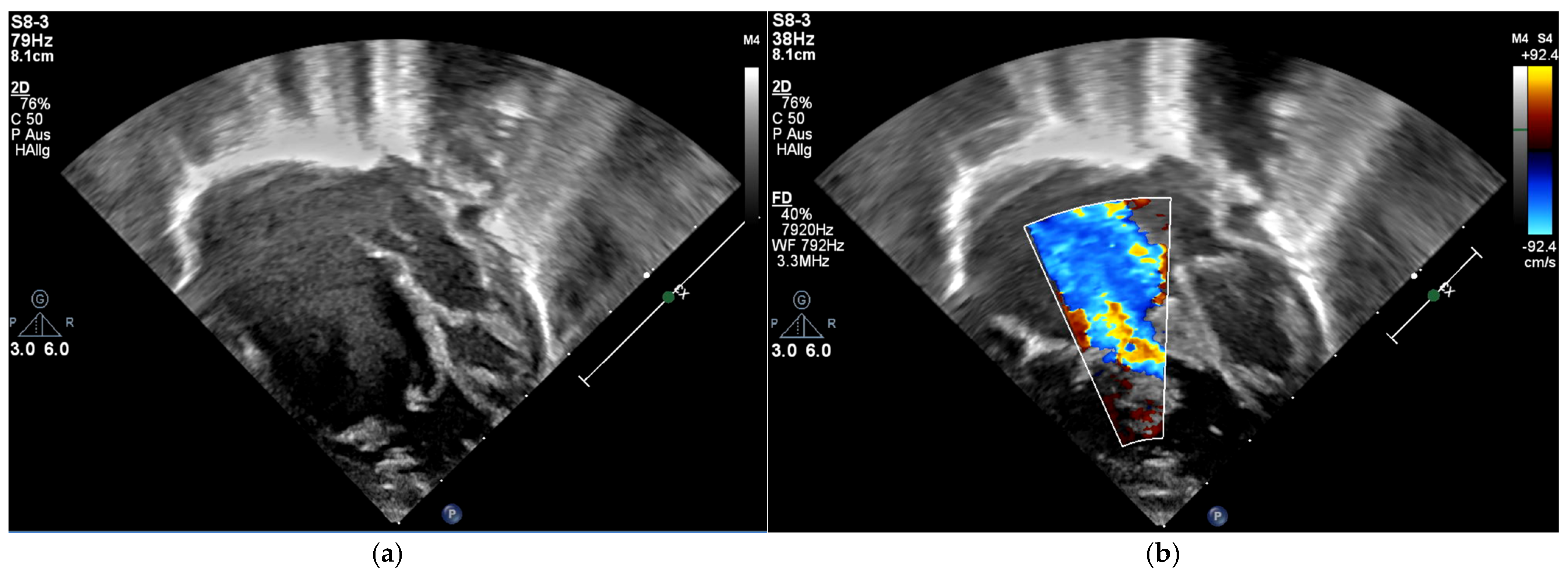 Children 12 00782 g002