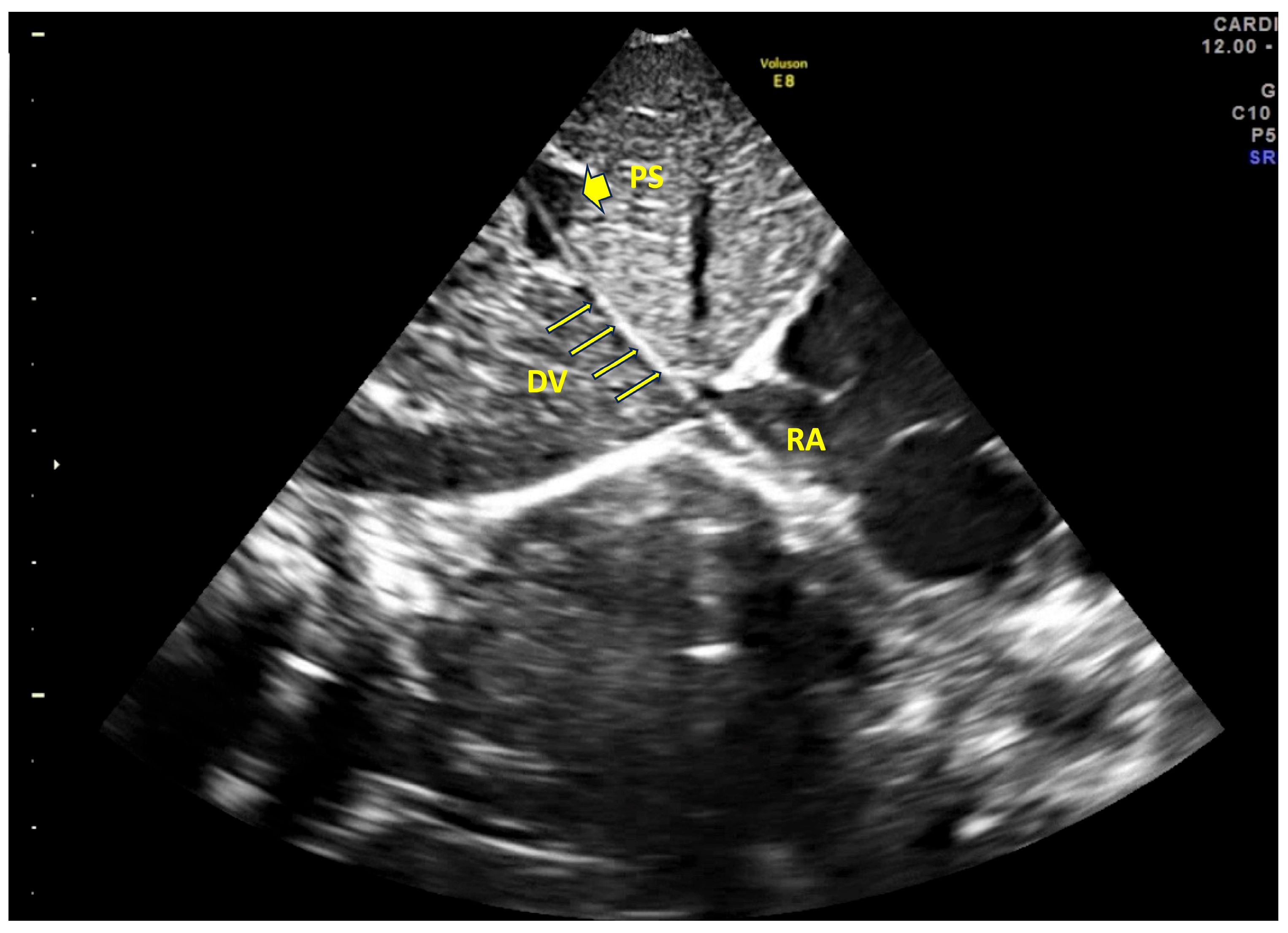 Children 12 00819 g001