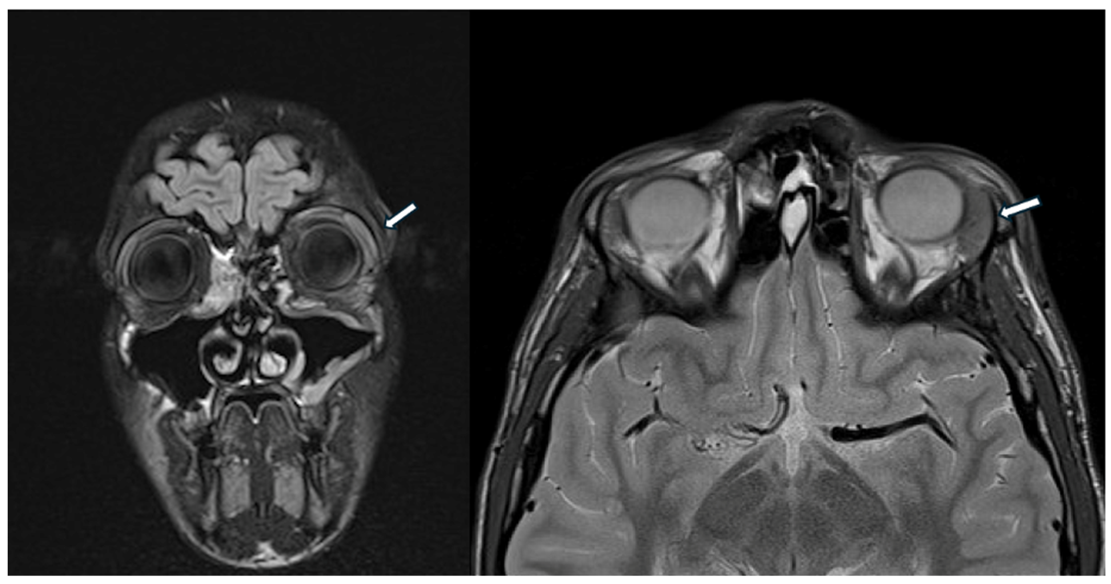 Children 12 00888 g003