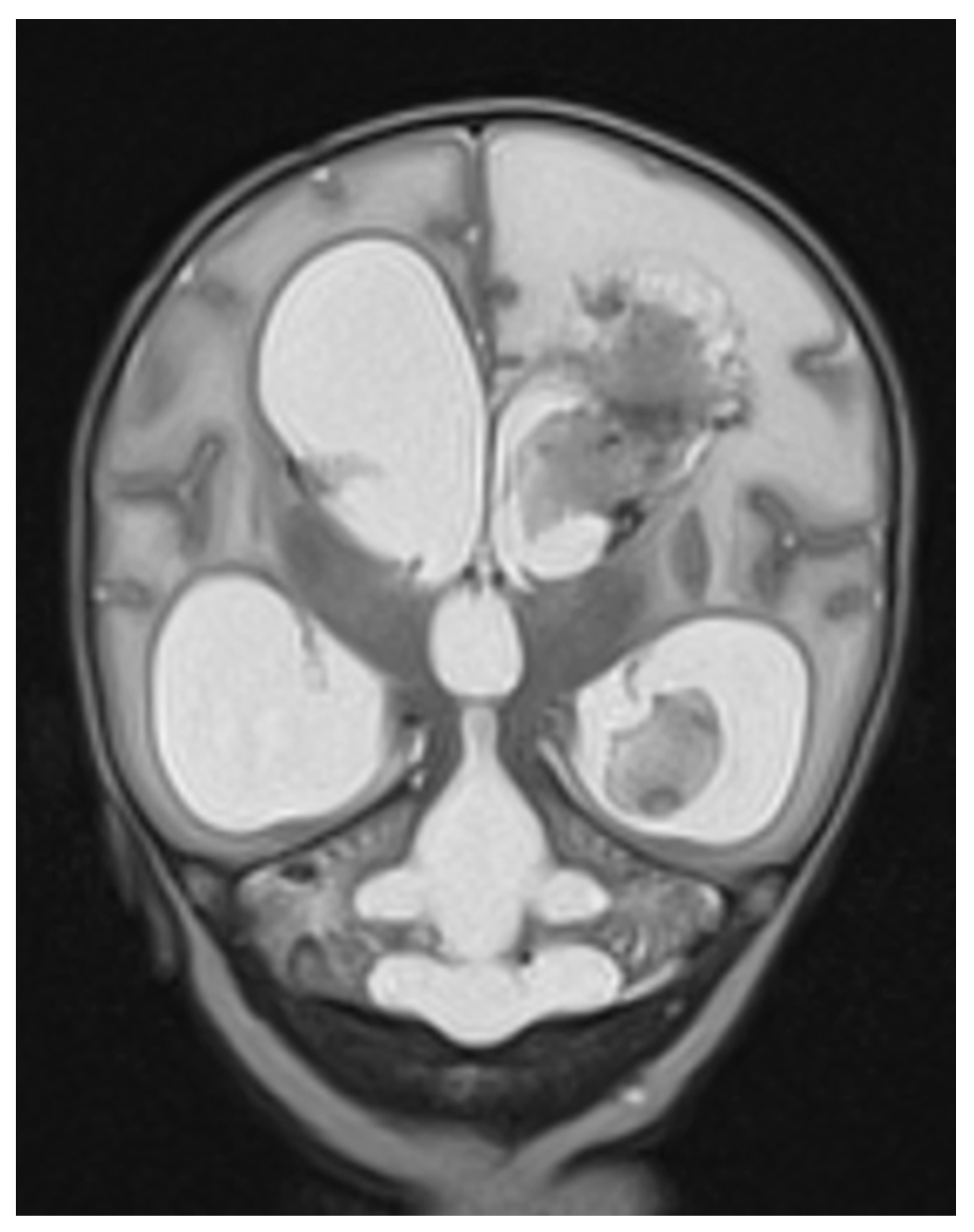 Children 12 00983 g0a1