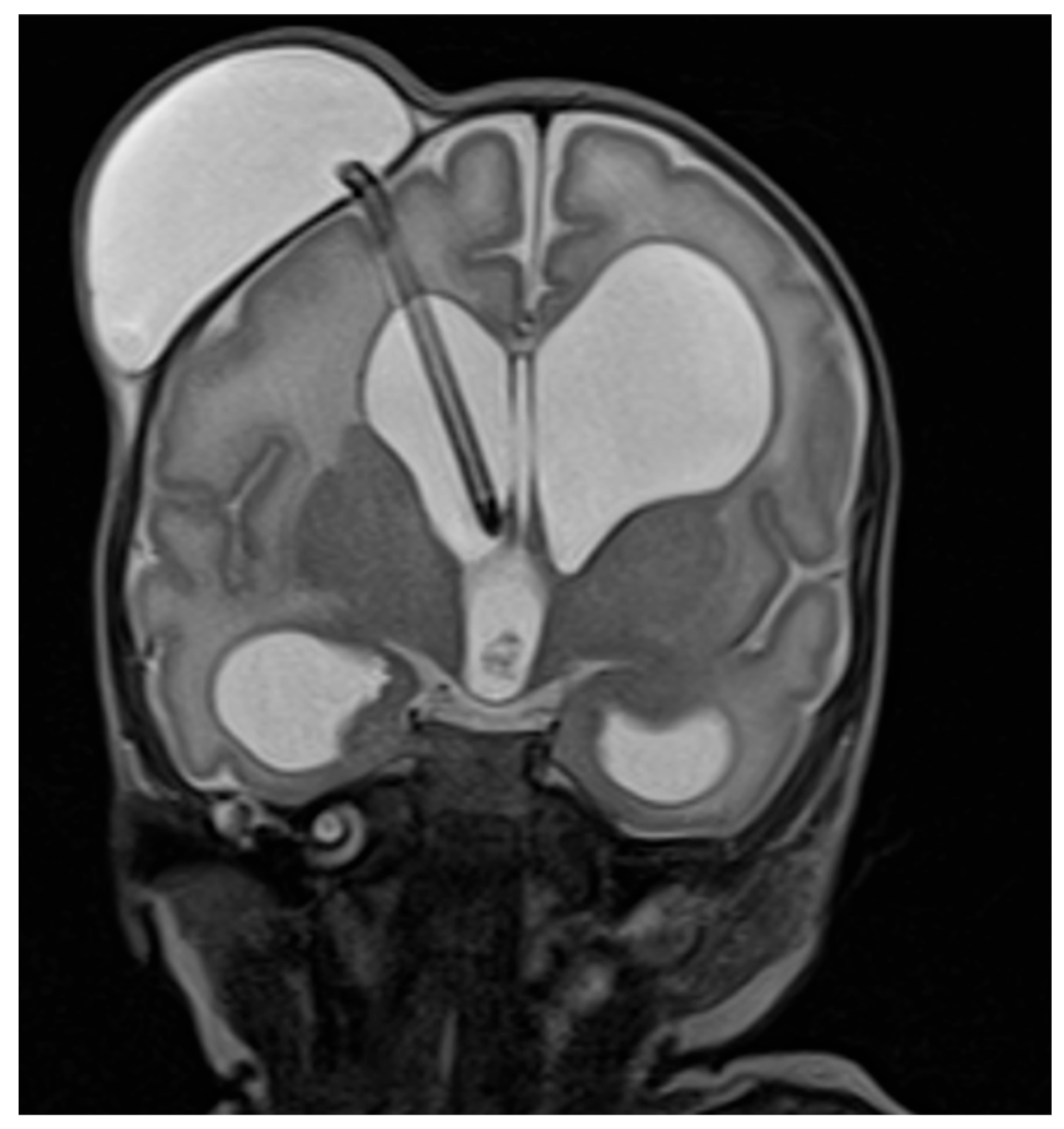 Children 12 00983 g0a2