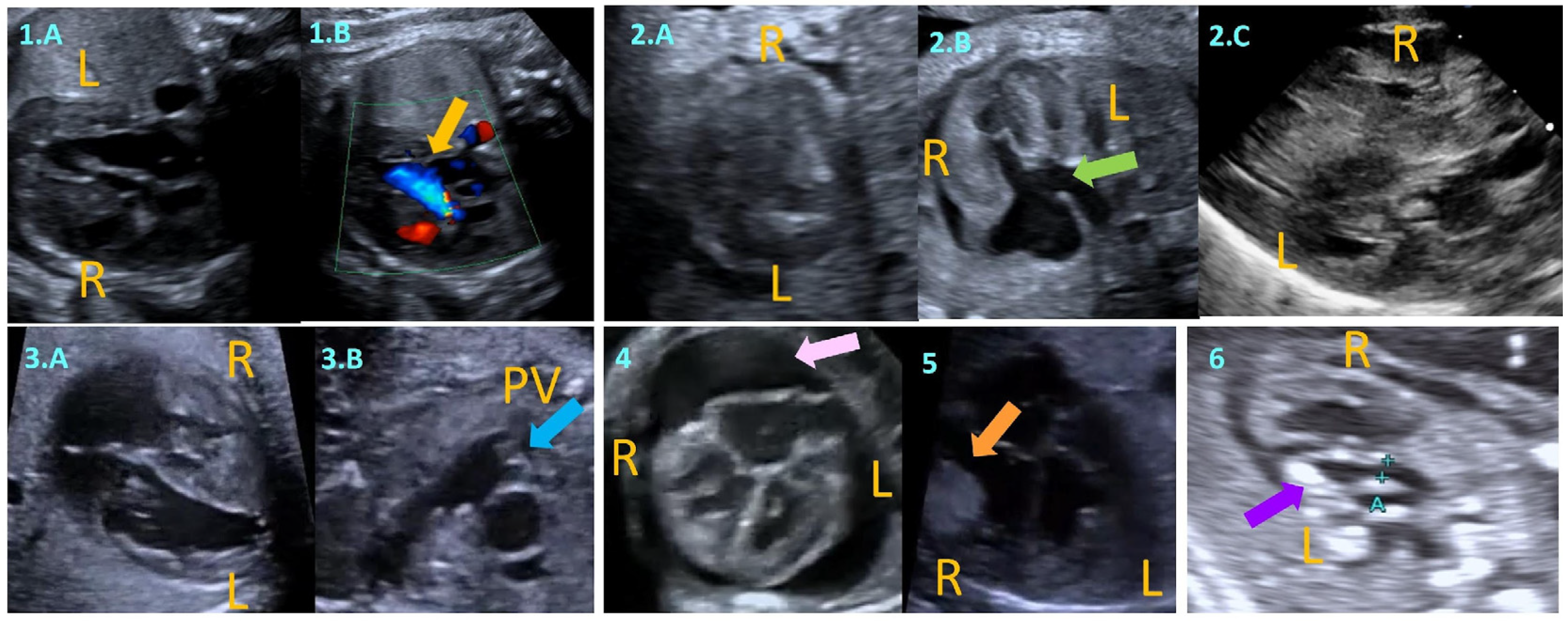 Children 12 00989 g001