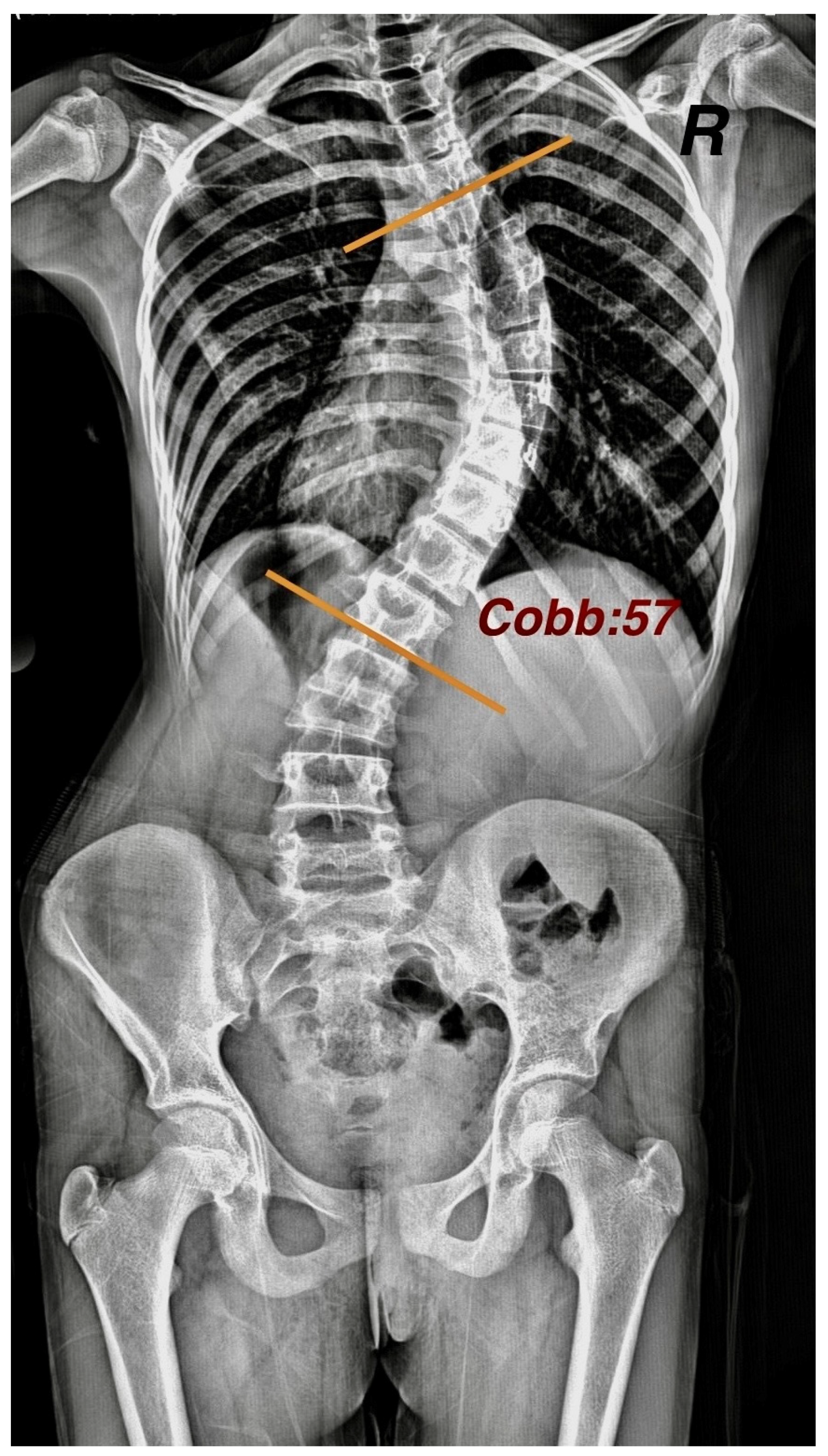 Children 12 00991 g002