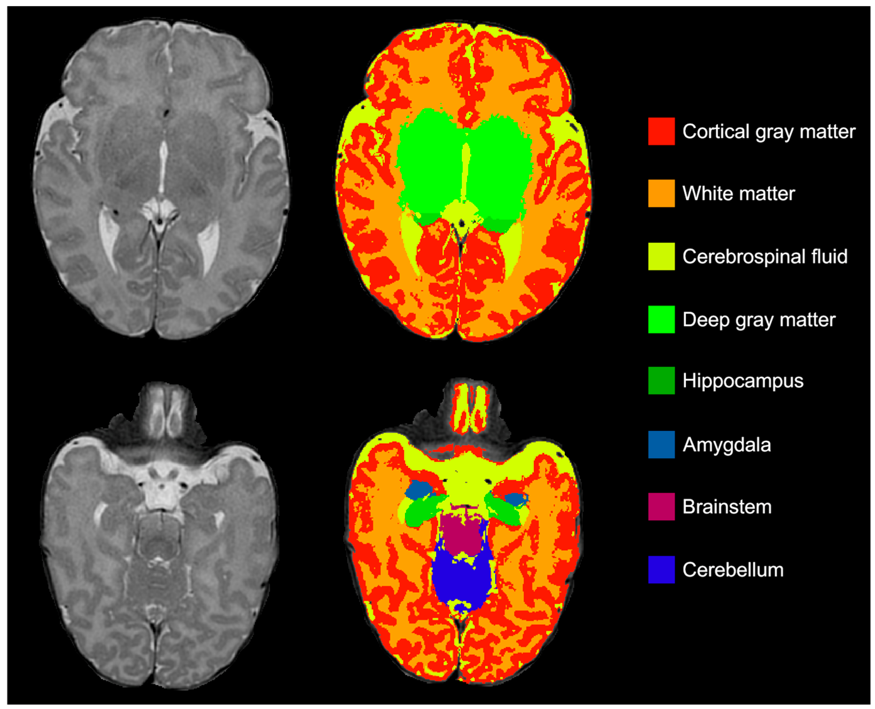 Children 12 01026 g001 Children 12 01026 g001