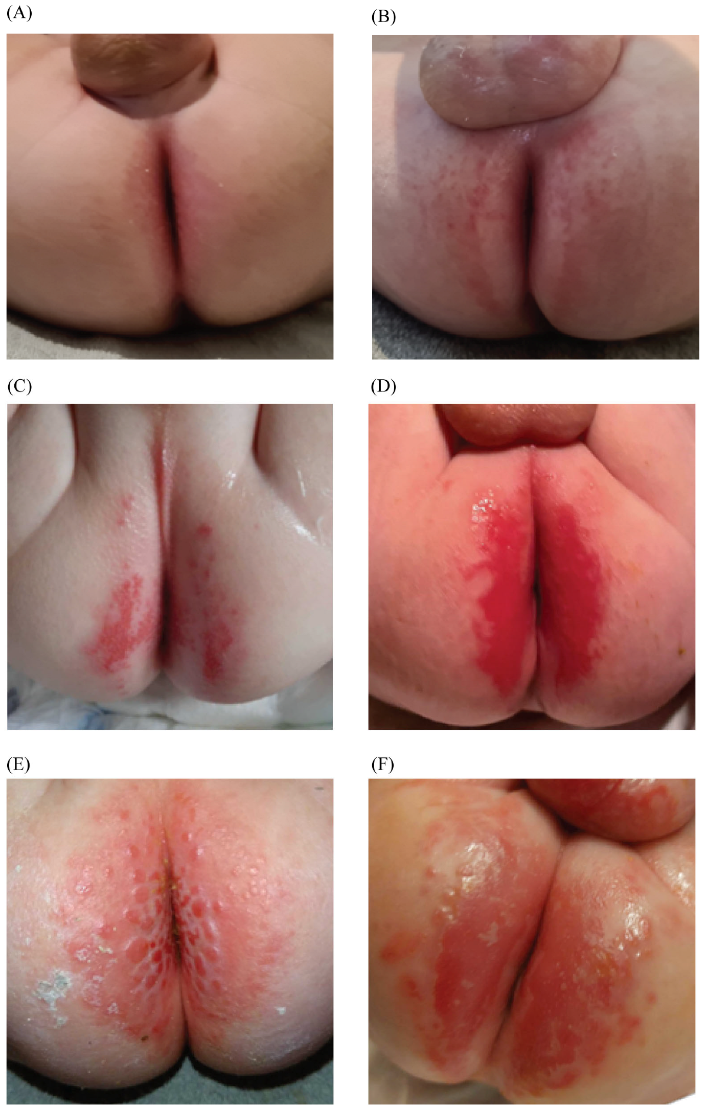 Children 12 01028 g002