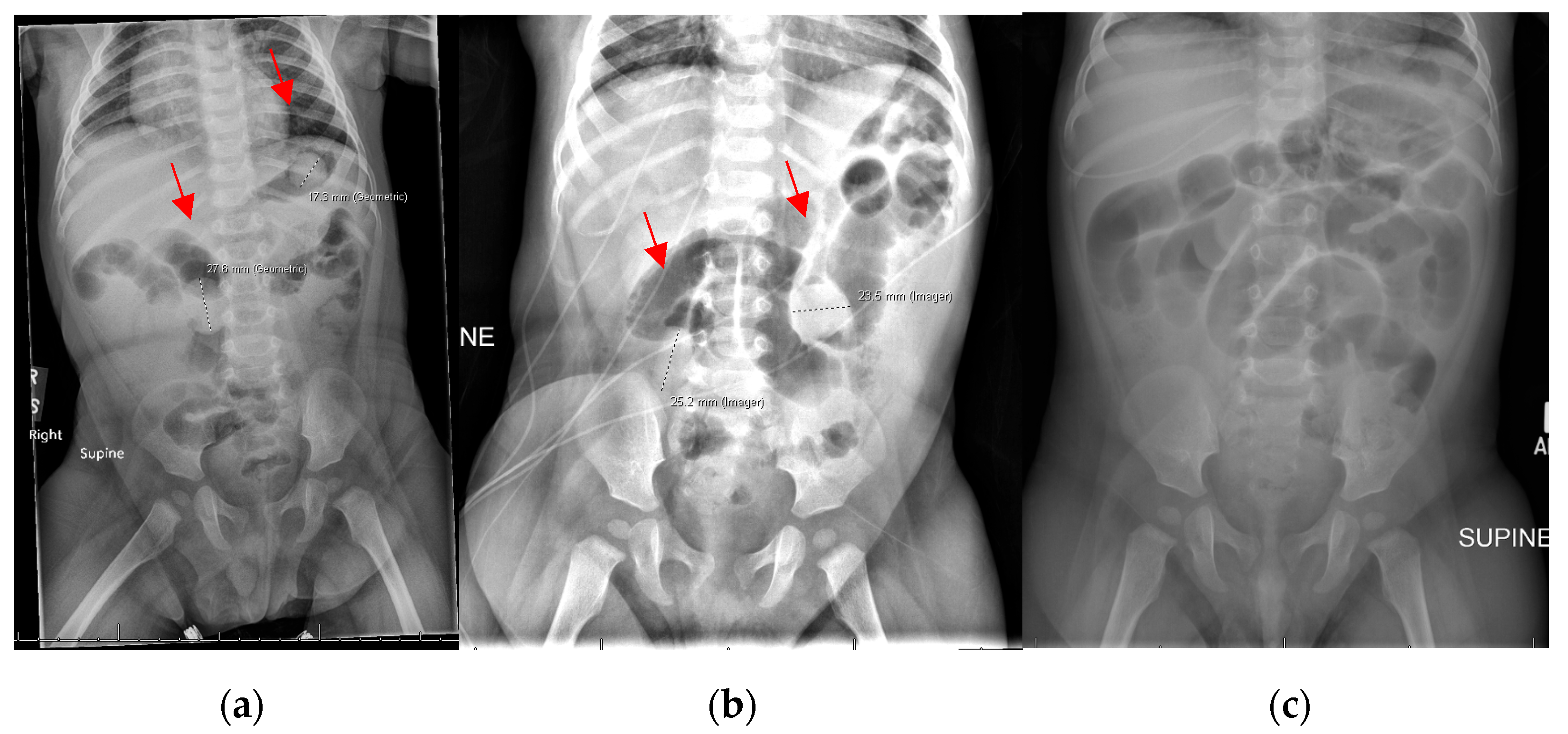 Children 12 01041 g003 Children 12 01041 g003