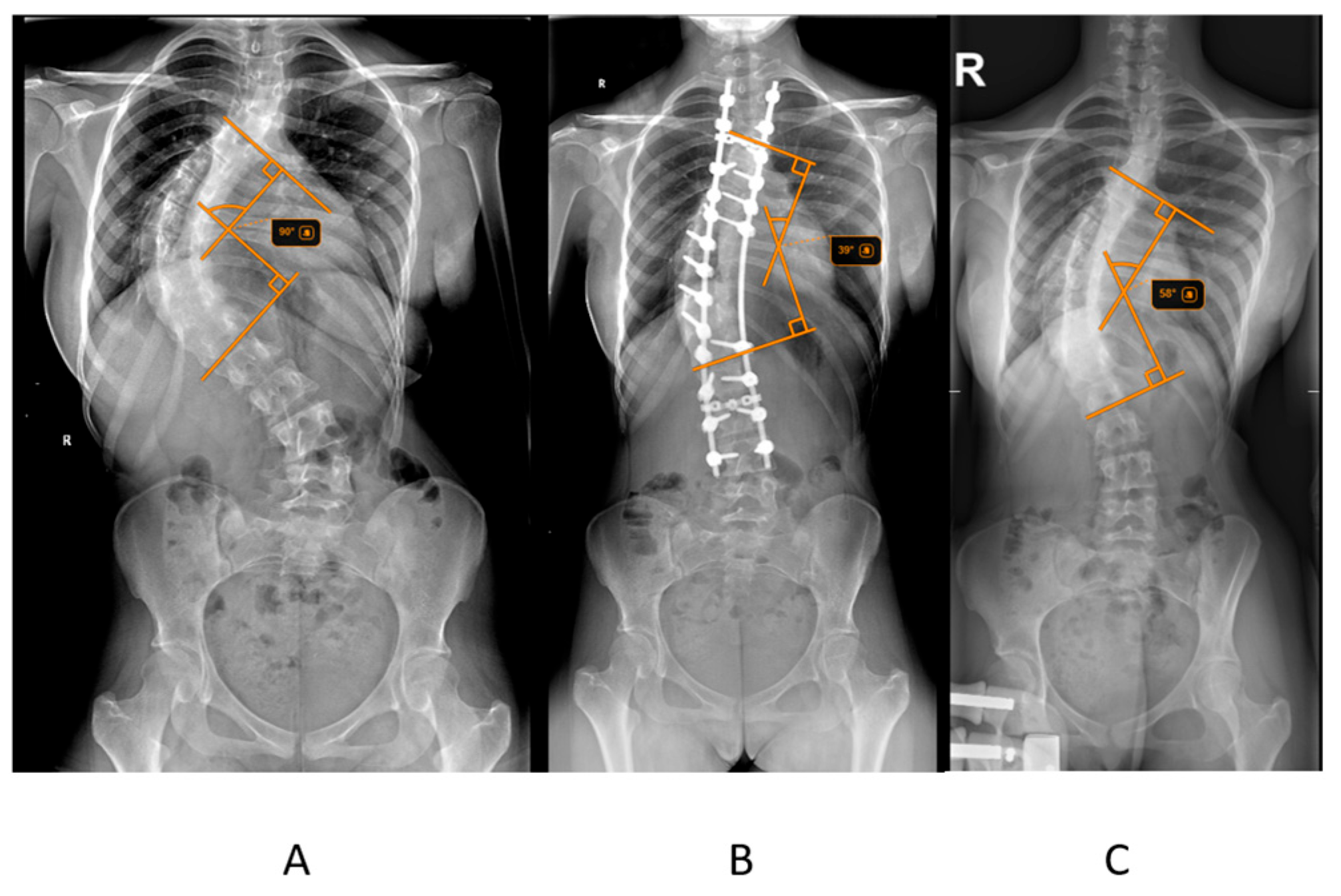 Children 12 01045 g001