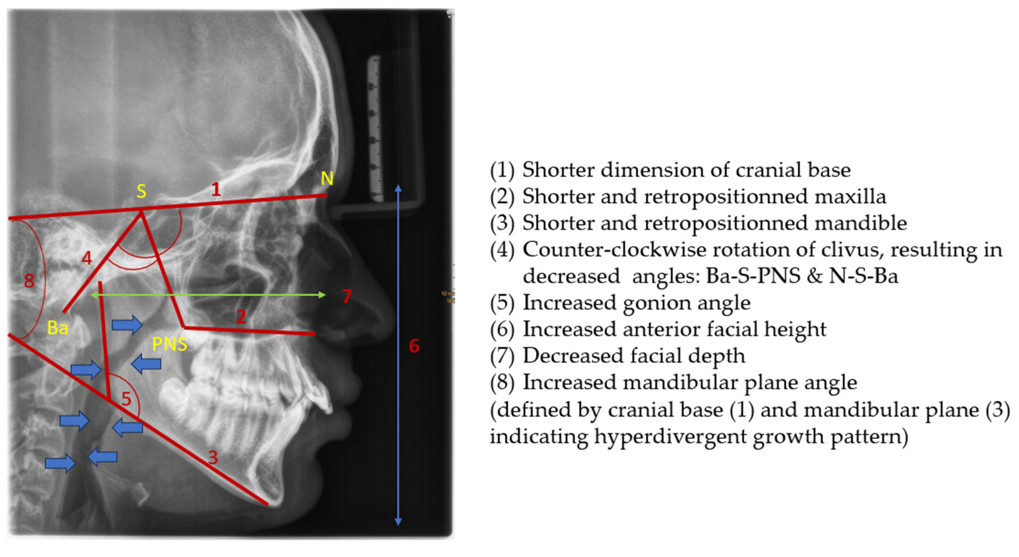 Children 12 01066 g003