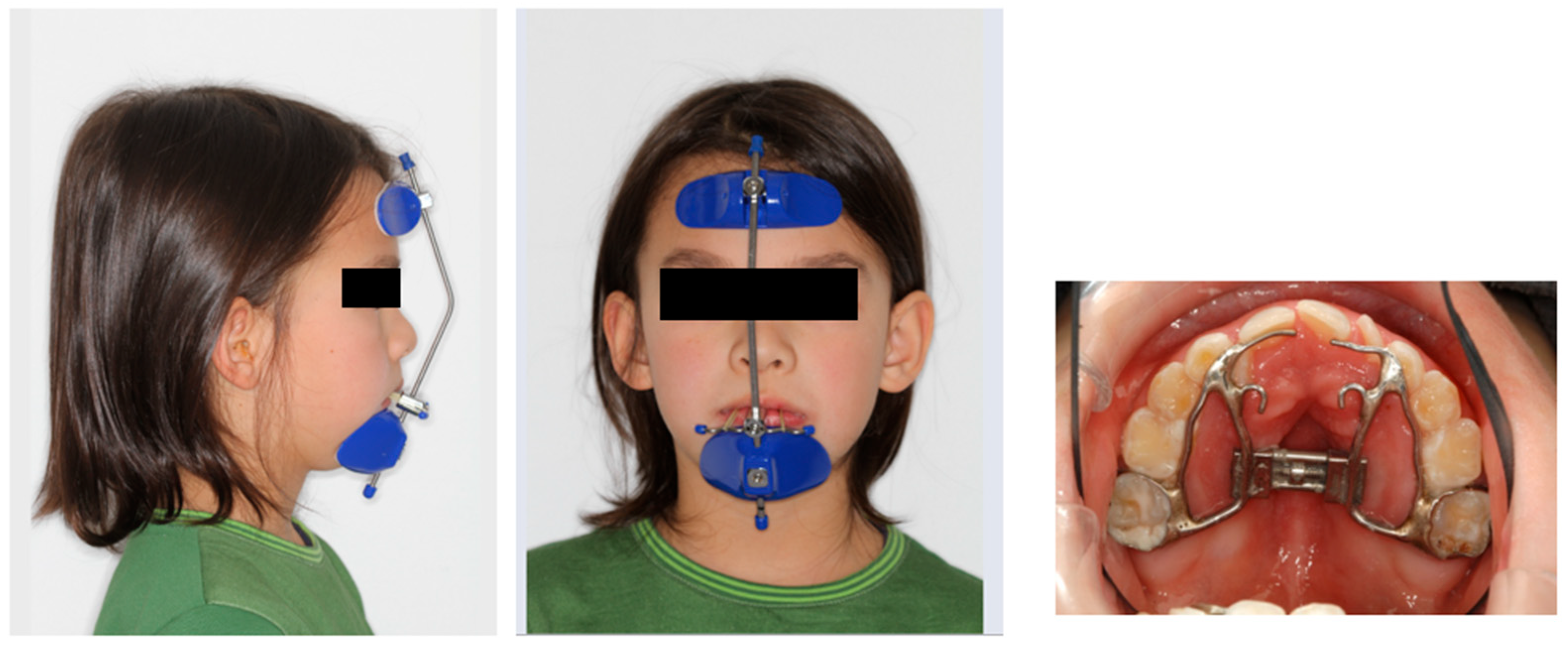 Children 12 01066 g011