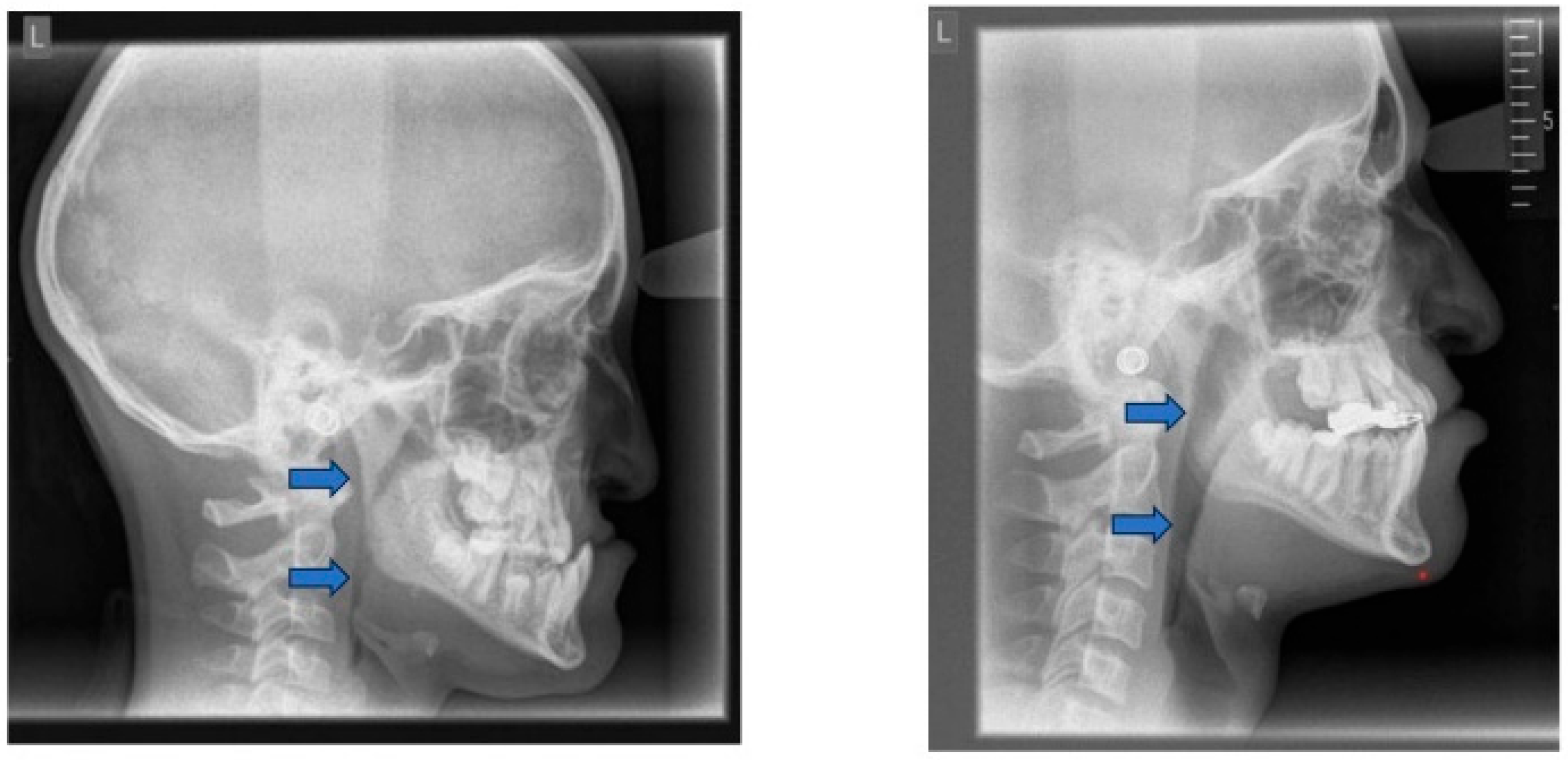 Children 12 01066 g012