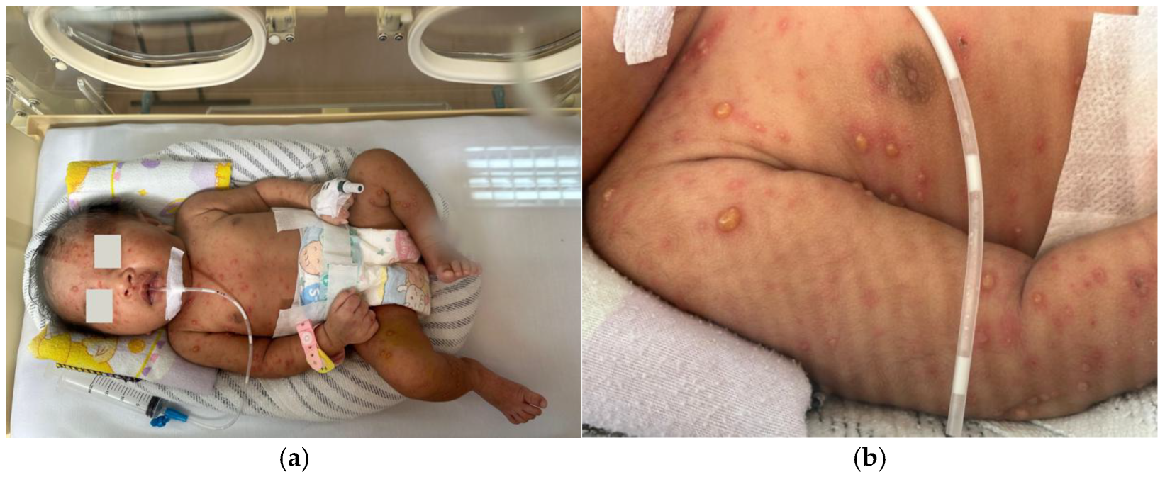 Children 12 01081 g001