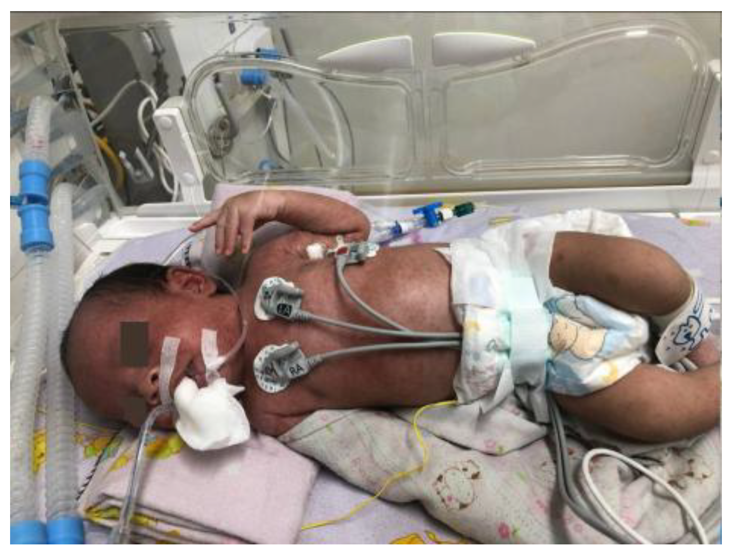 Children 12 01081 g004