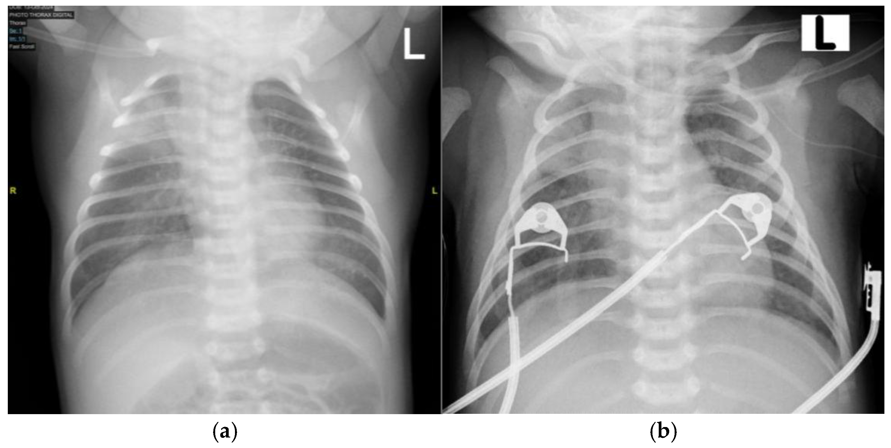 Children 12 01081 g005