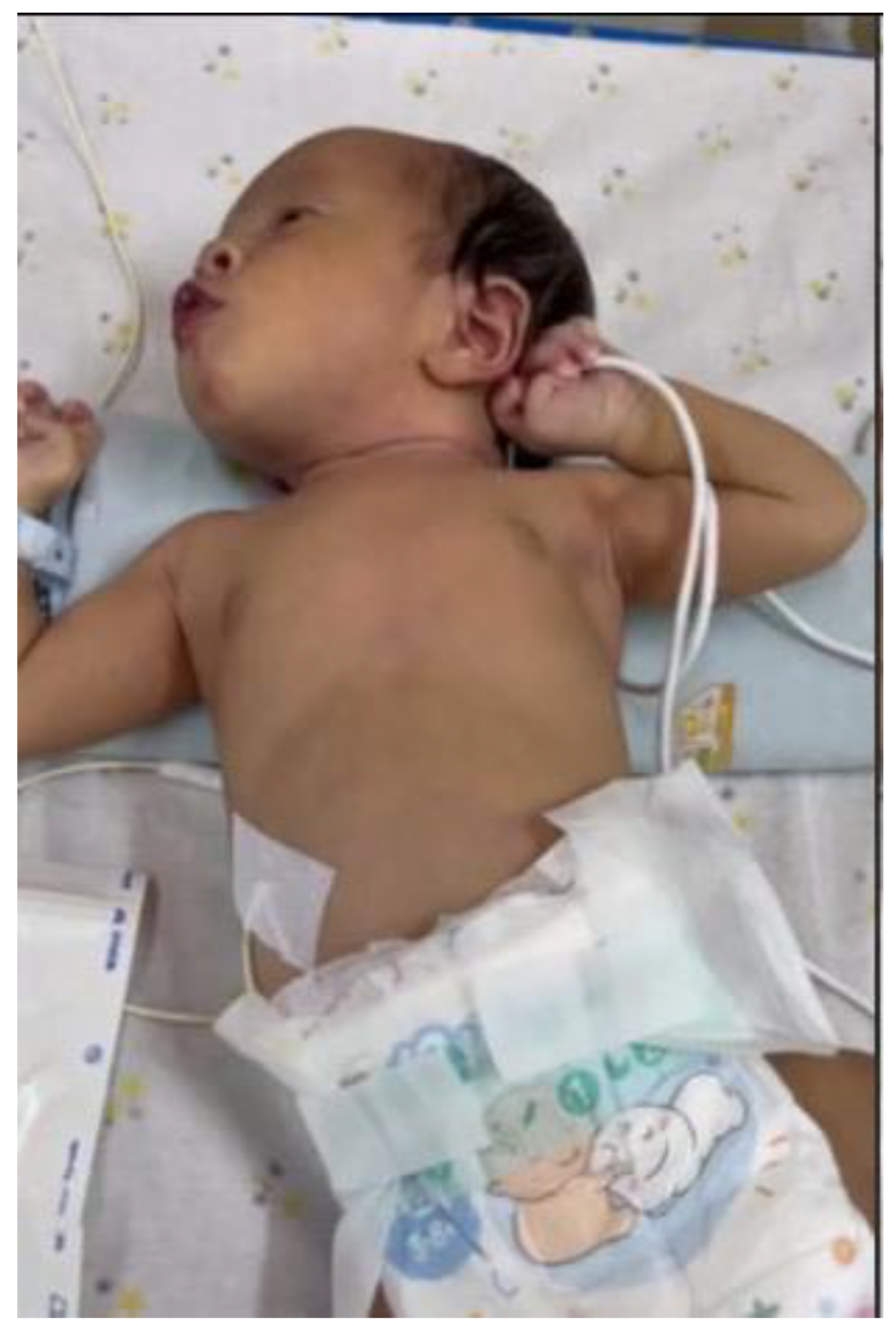 Children 12 01081 g006