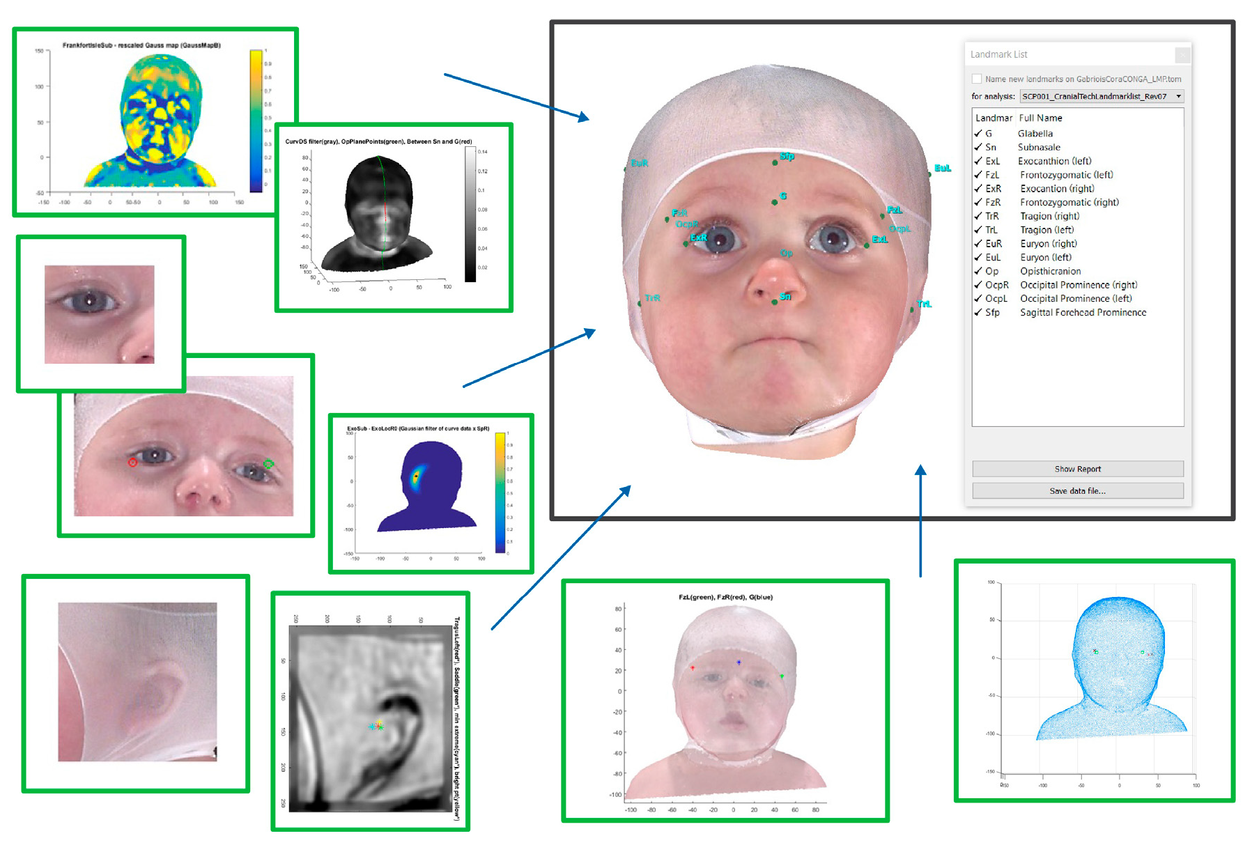 Children 12 01099 g001