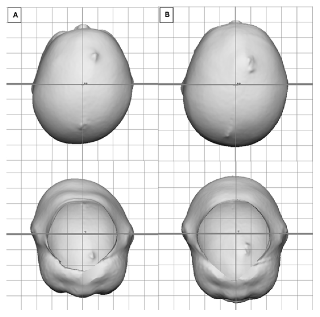 Children 12 01099 g004