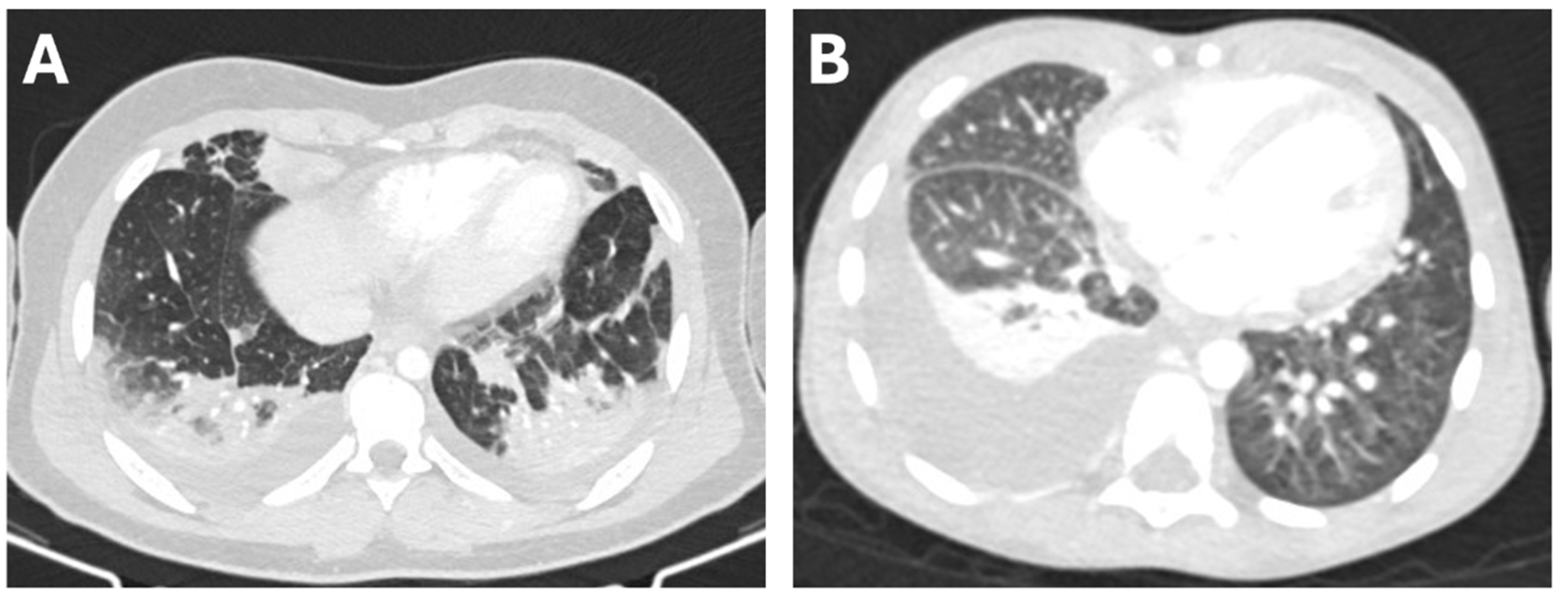 Children 12 01103 g001 Children 12 01103 g001