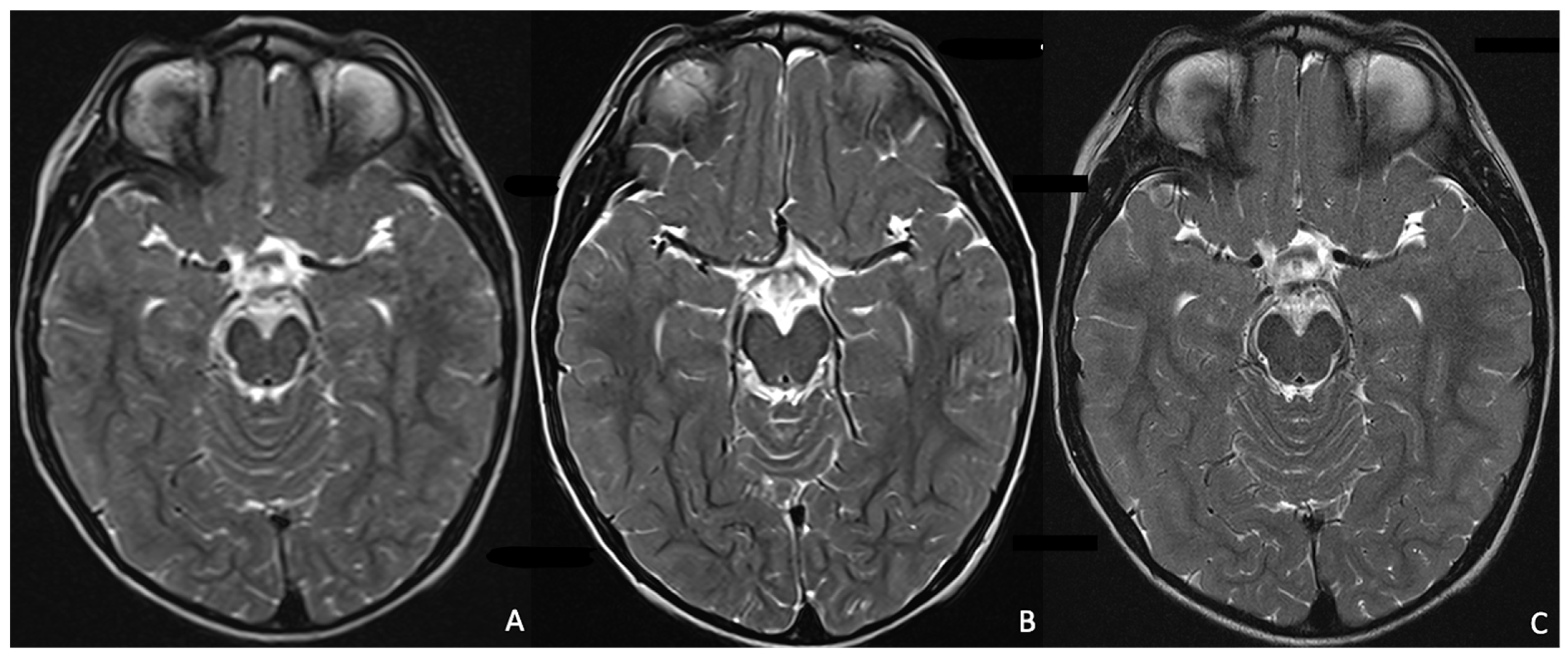 Children 12 01127 g003 Children 12 01127 g003