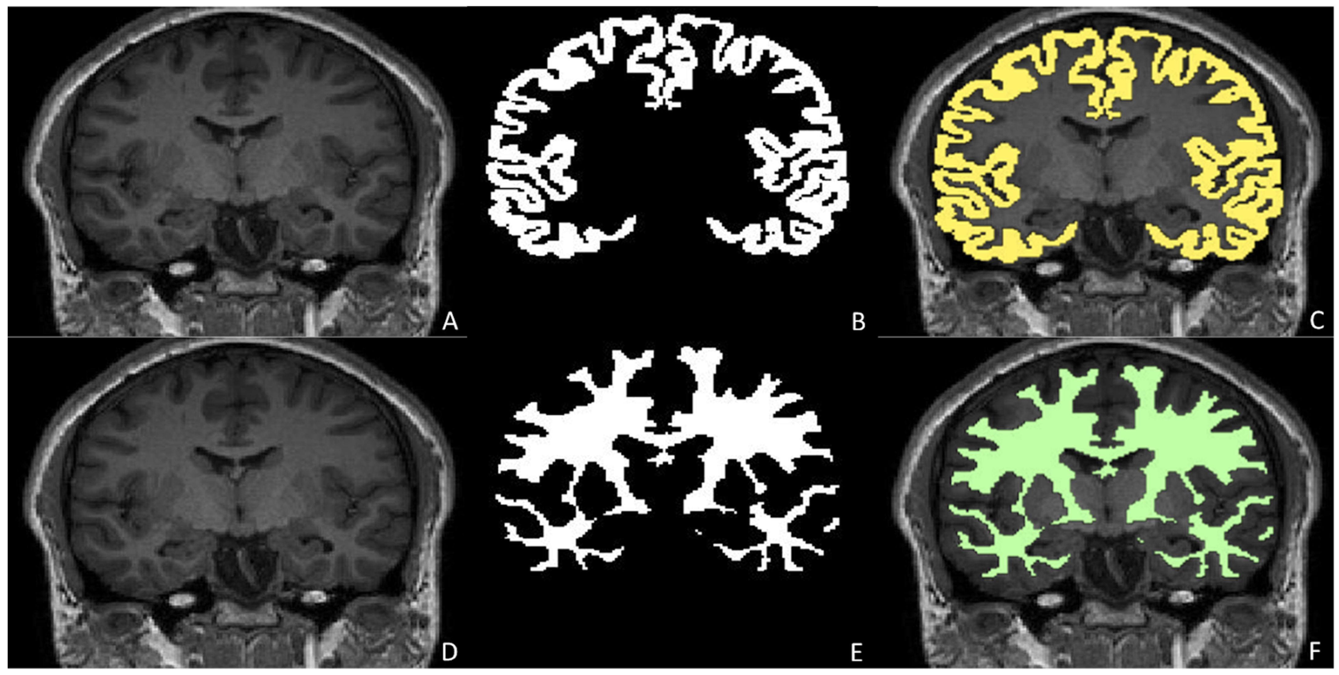 Children 12 01127 g004 Children 12 01127 g004