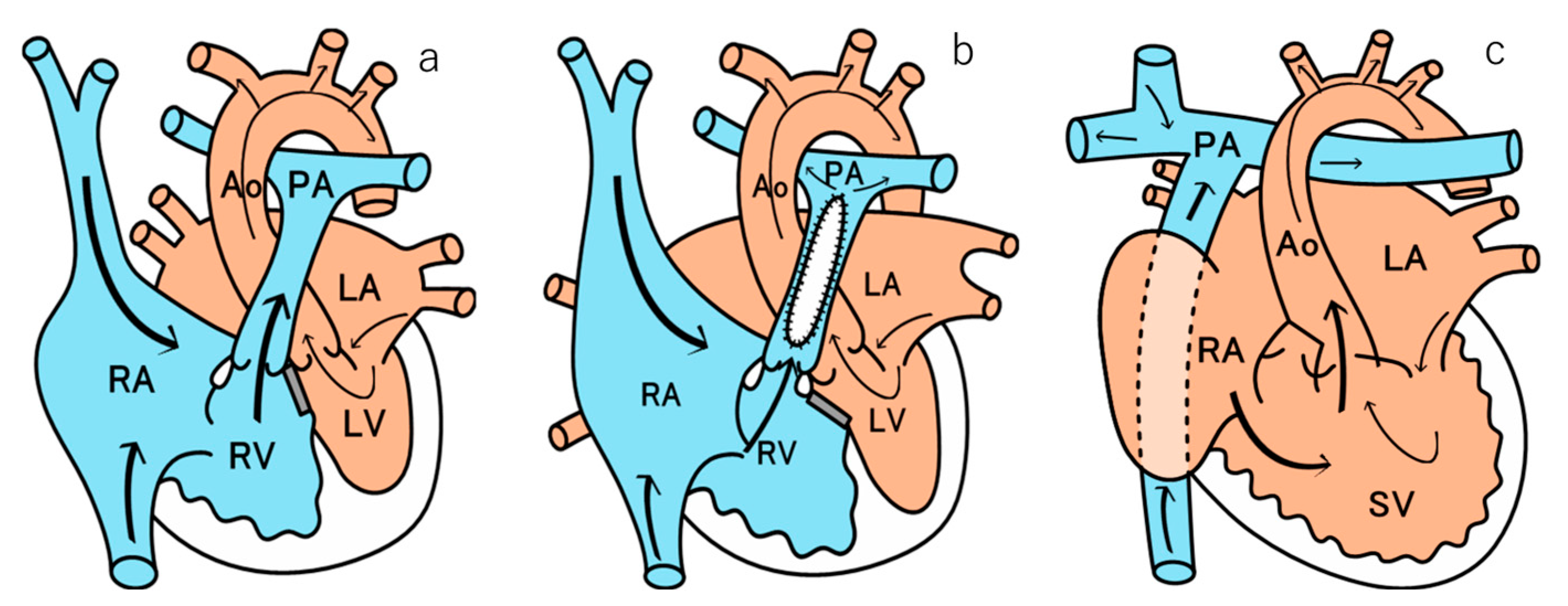 Children 12 01131 g001