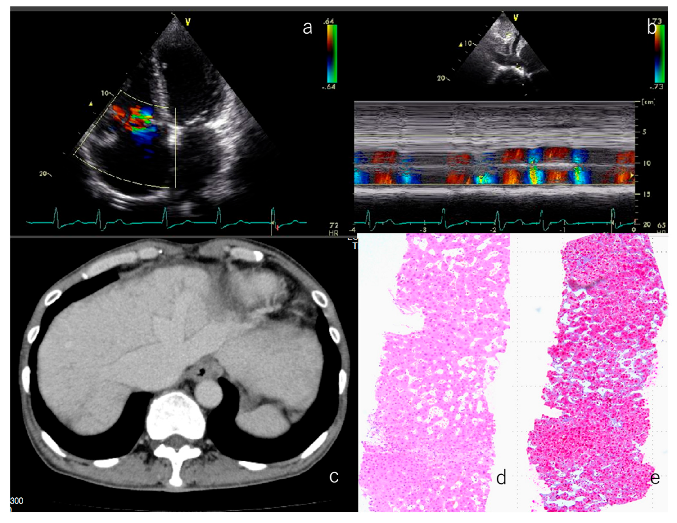 Children 12 01131 g005