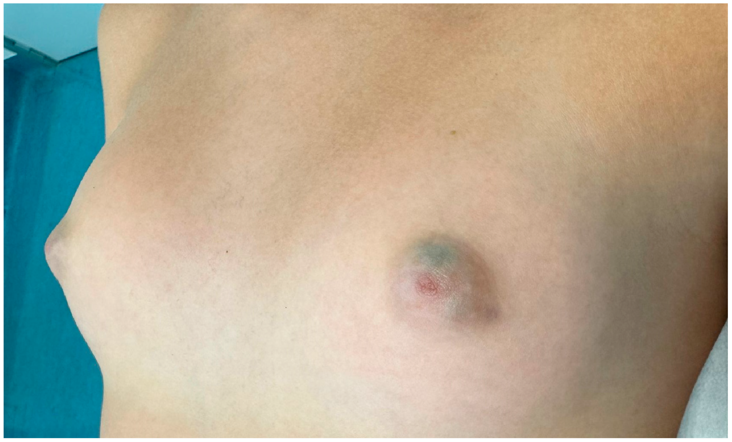 Children 12 01224 g001 Children 12 01224 g001