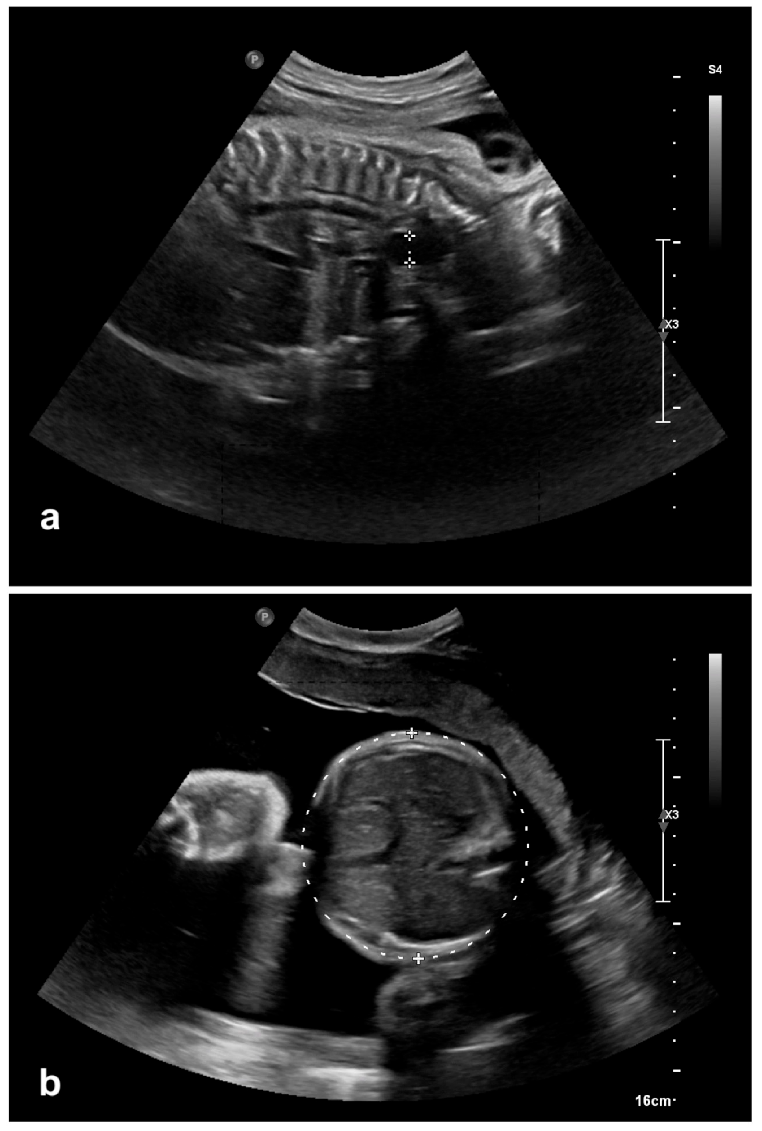 Children 12 01244 g001