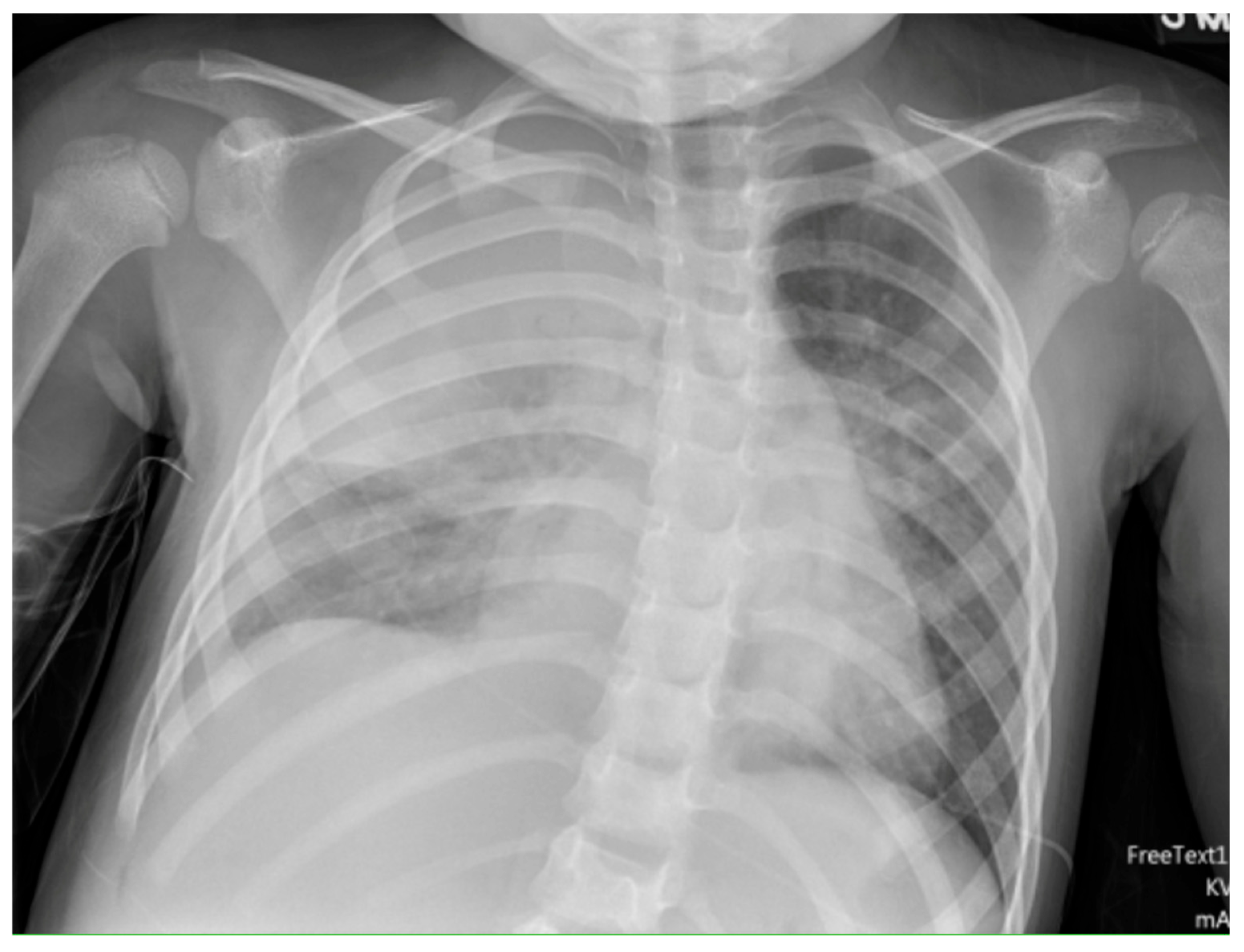 Children 12 01248 g003