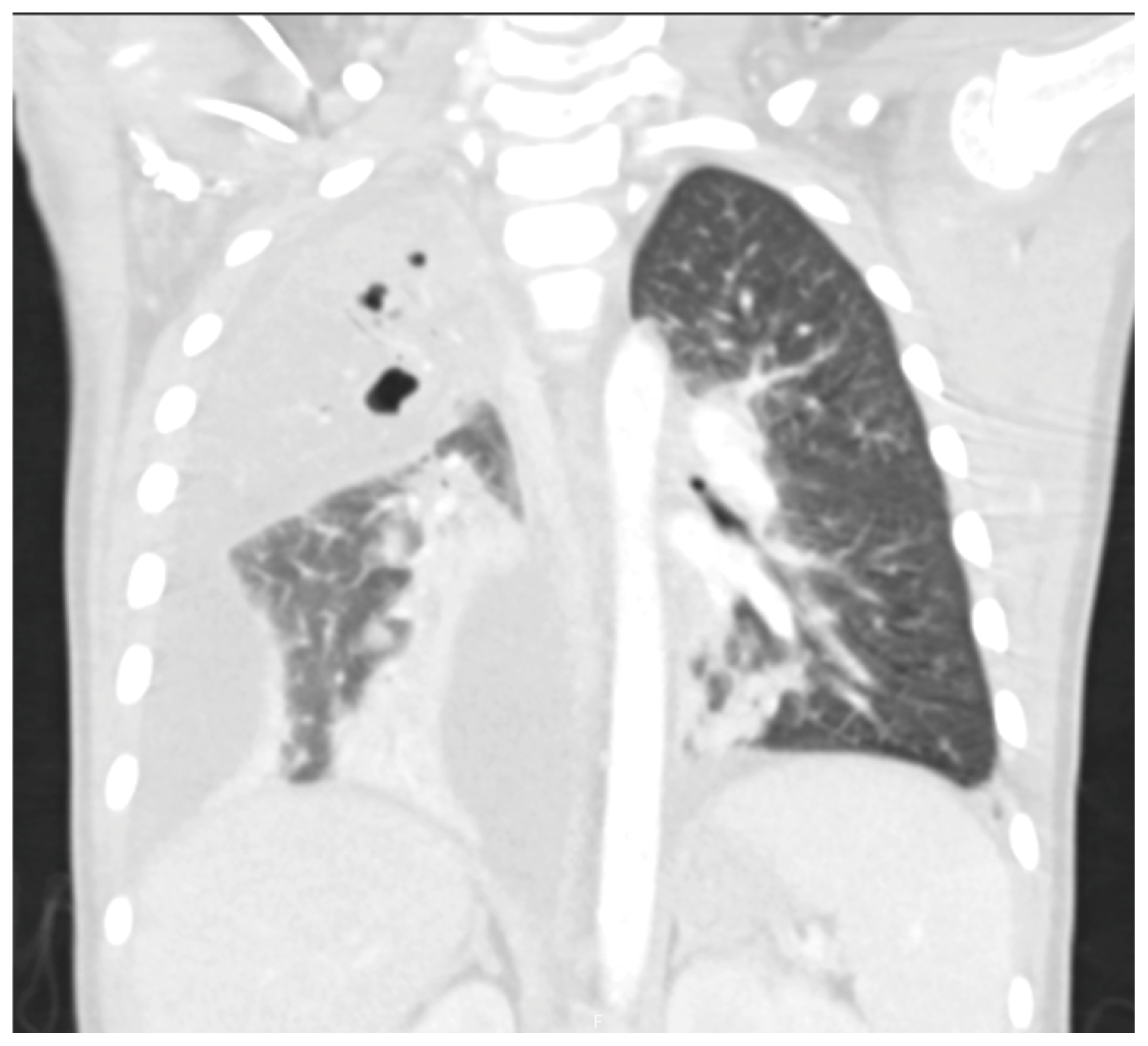 Children 12 01248 g004