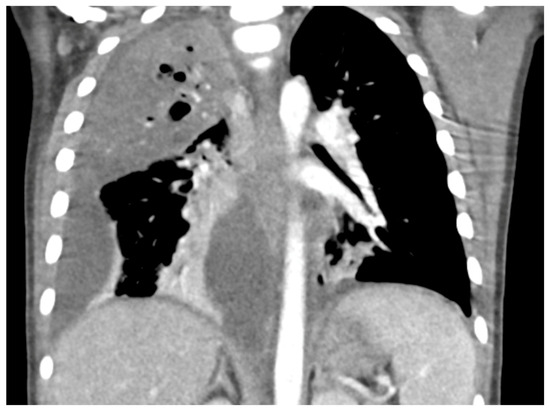 【young】 51pvXLg-yCL.jpg_BO30,255,255,