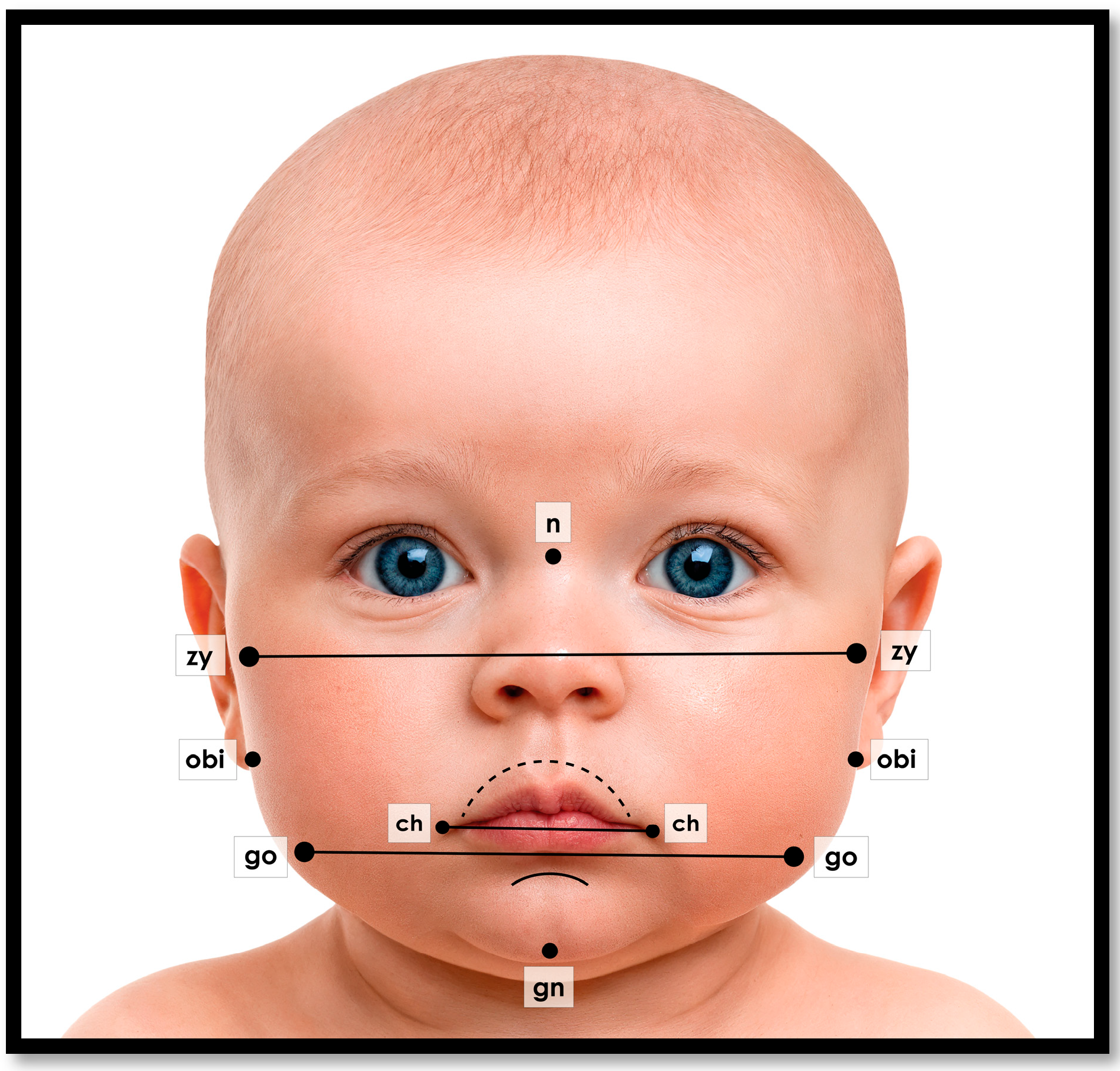 Children 12 01257 g005