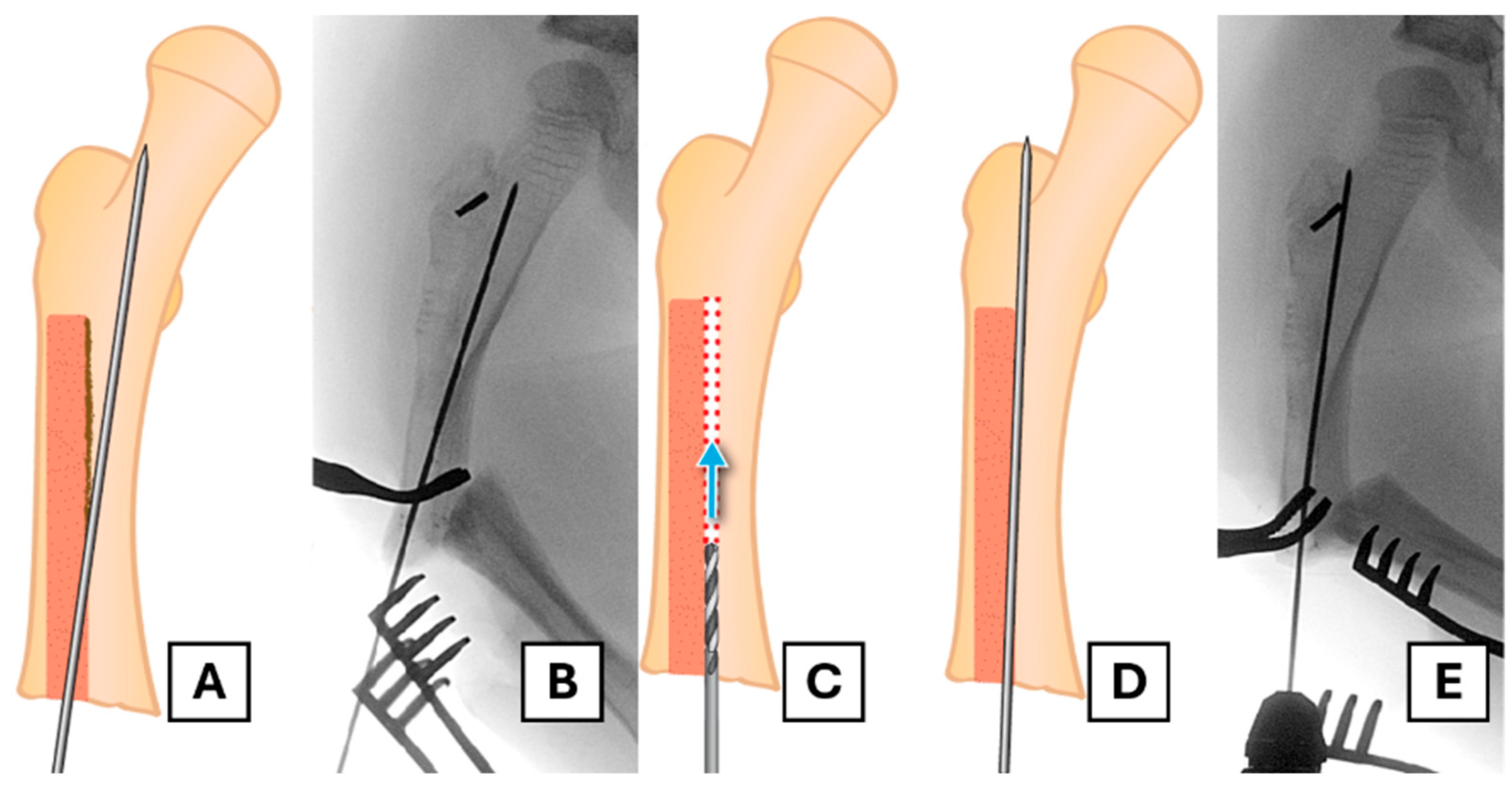 Children 12 01269 g005