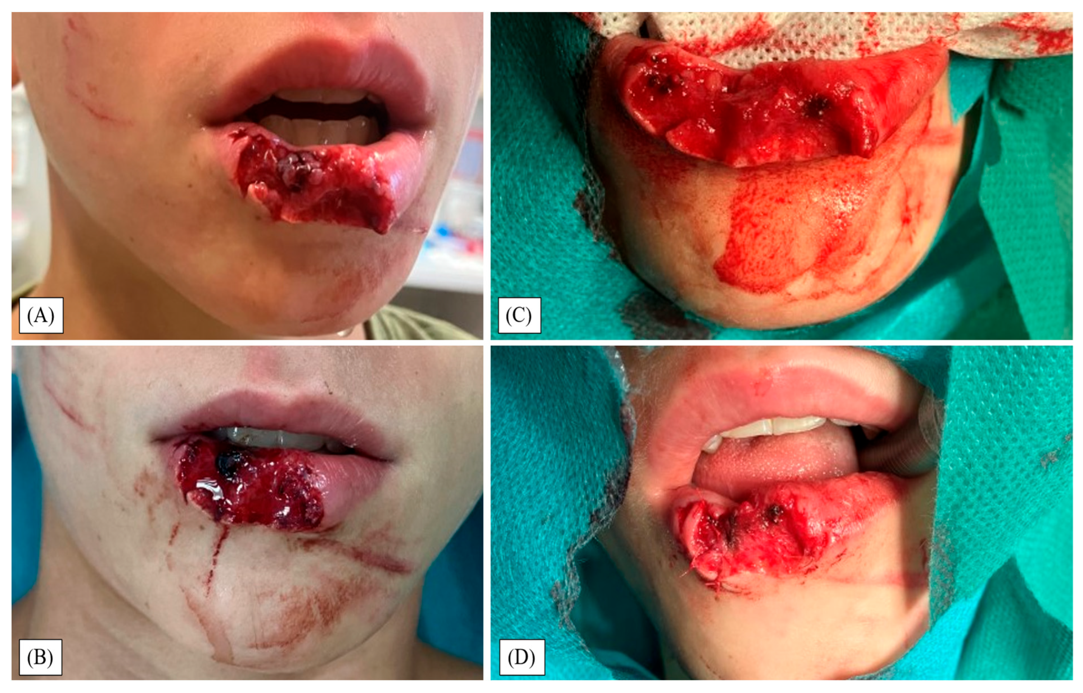 Children 12 01308 g001