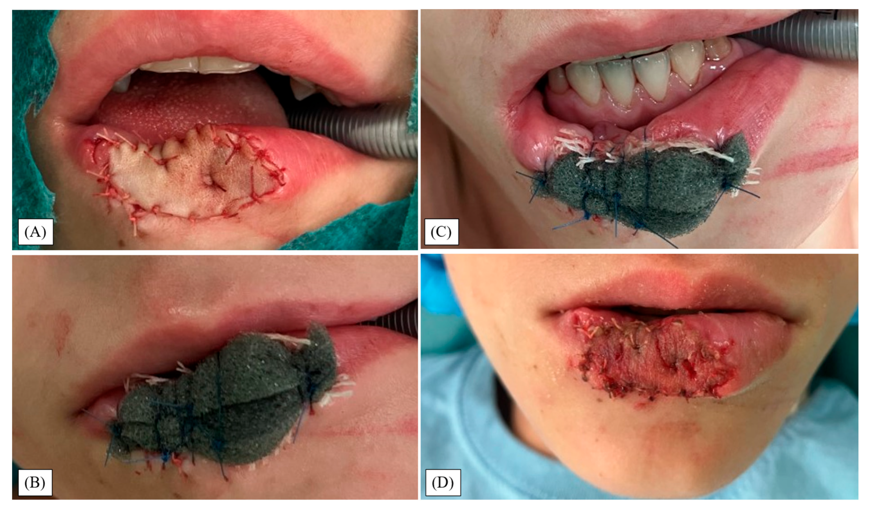 Children 12 01308 g002