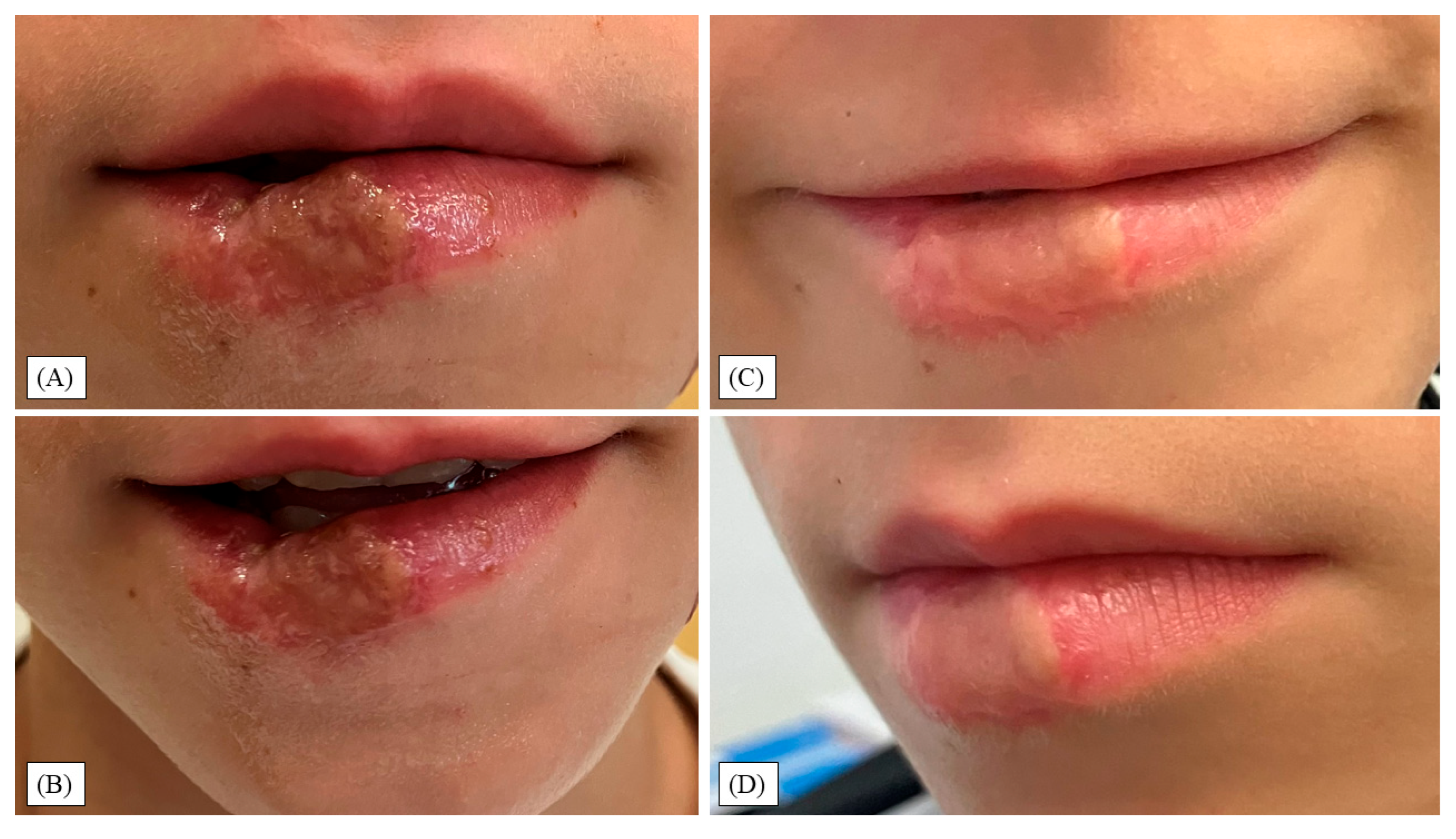 Children 12 01308 g003