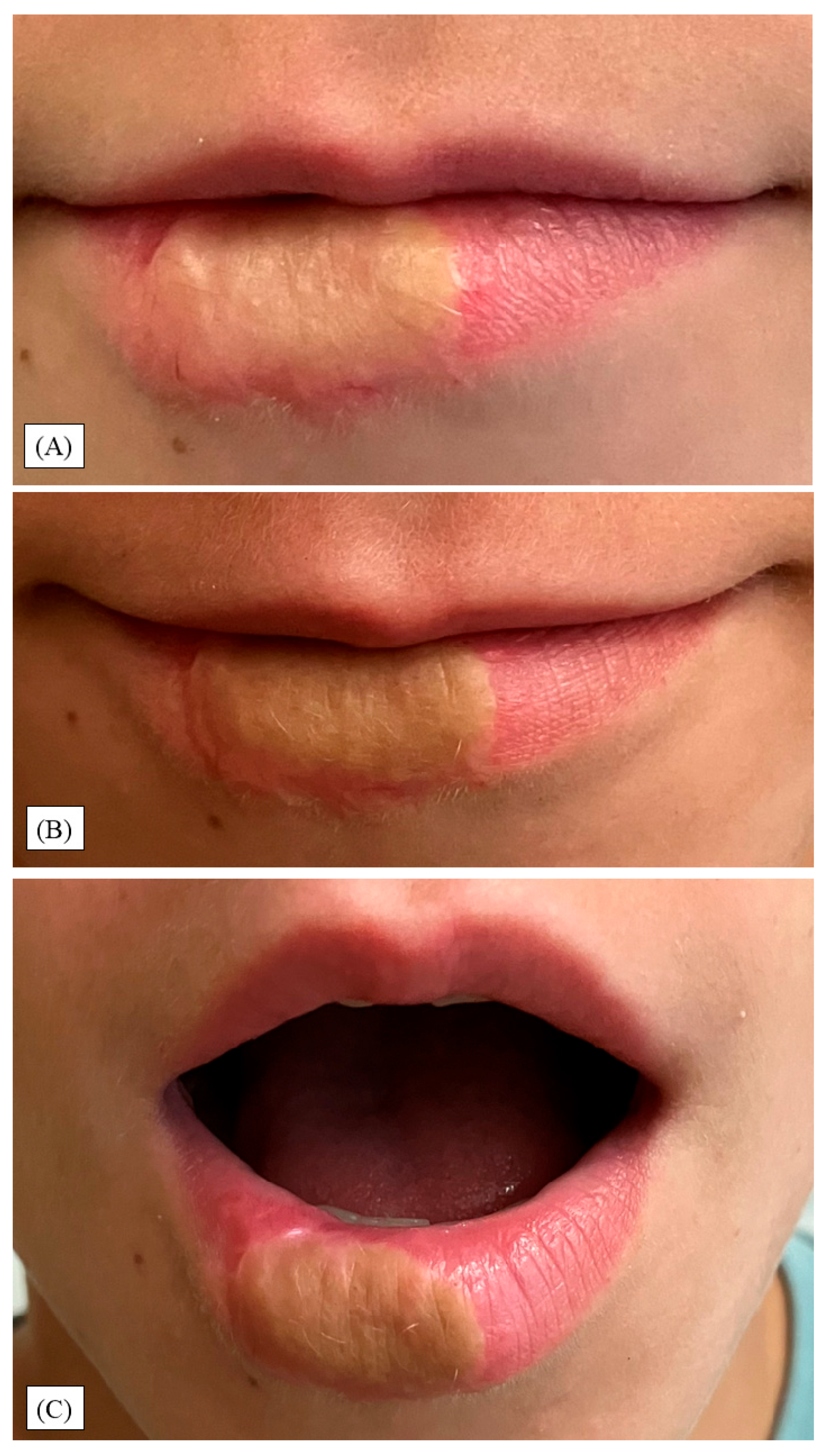 Children 12 01308 g004