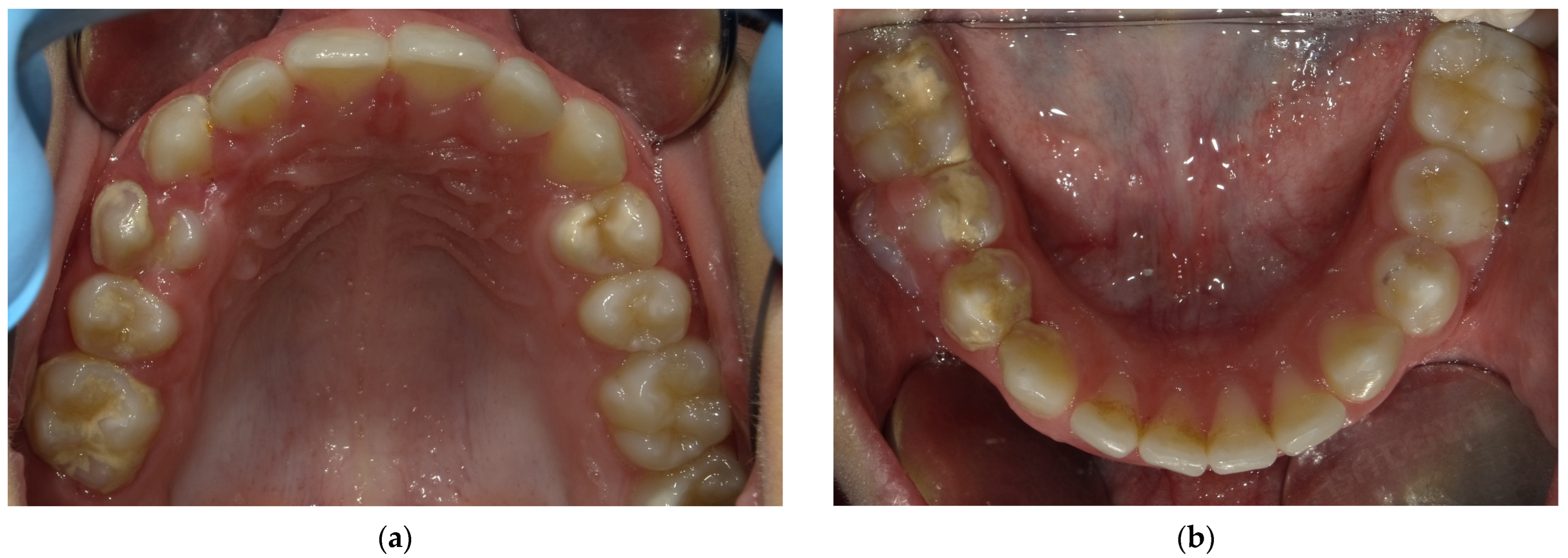 Children 12 01331 g002 Children 12 01331 g002