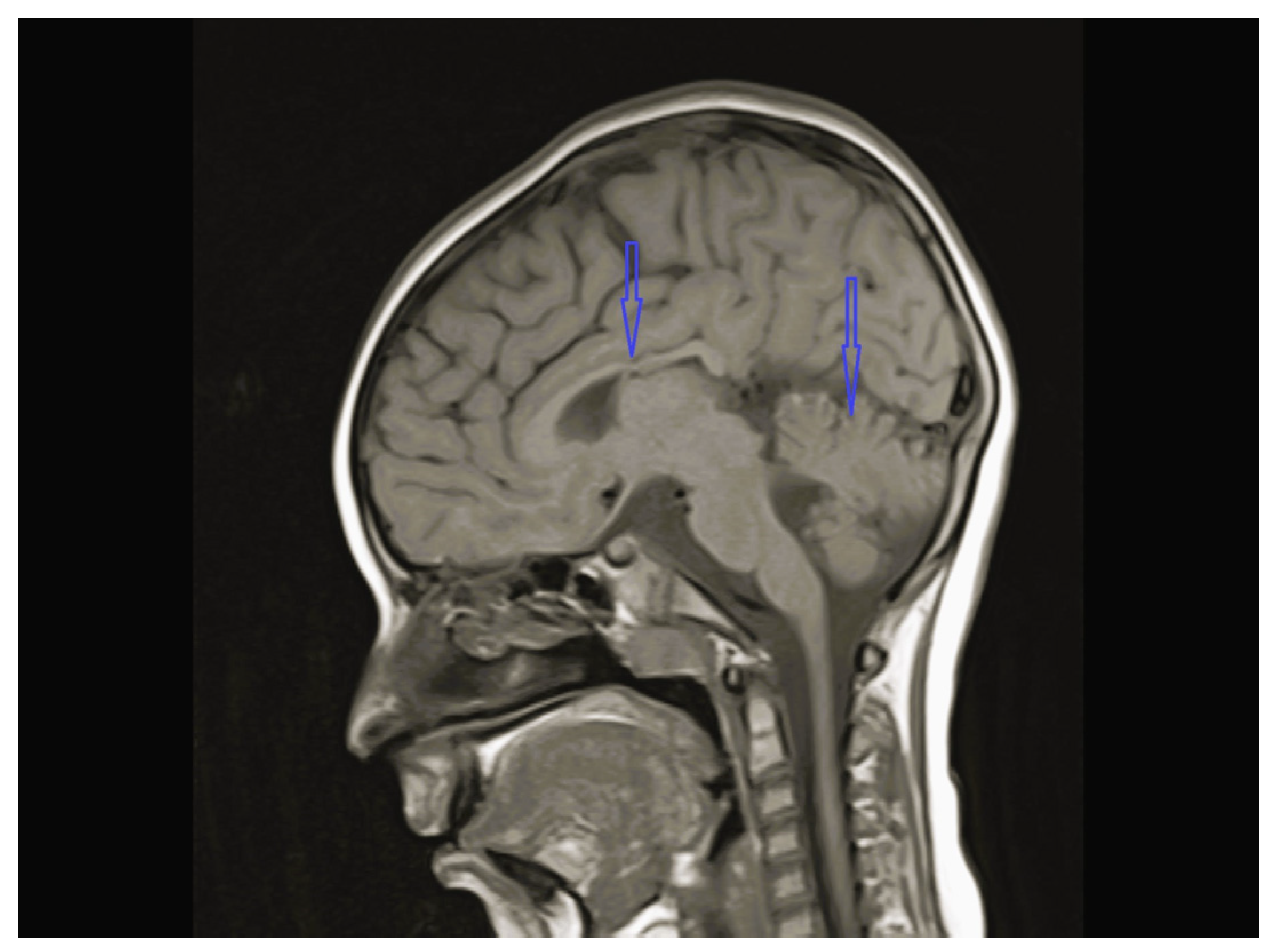 Children 12 01332 g003 Children 12 01332 g003