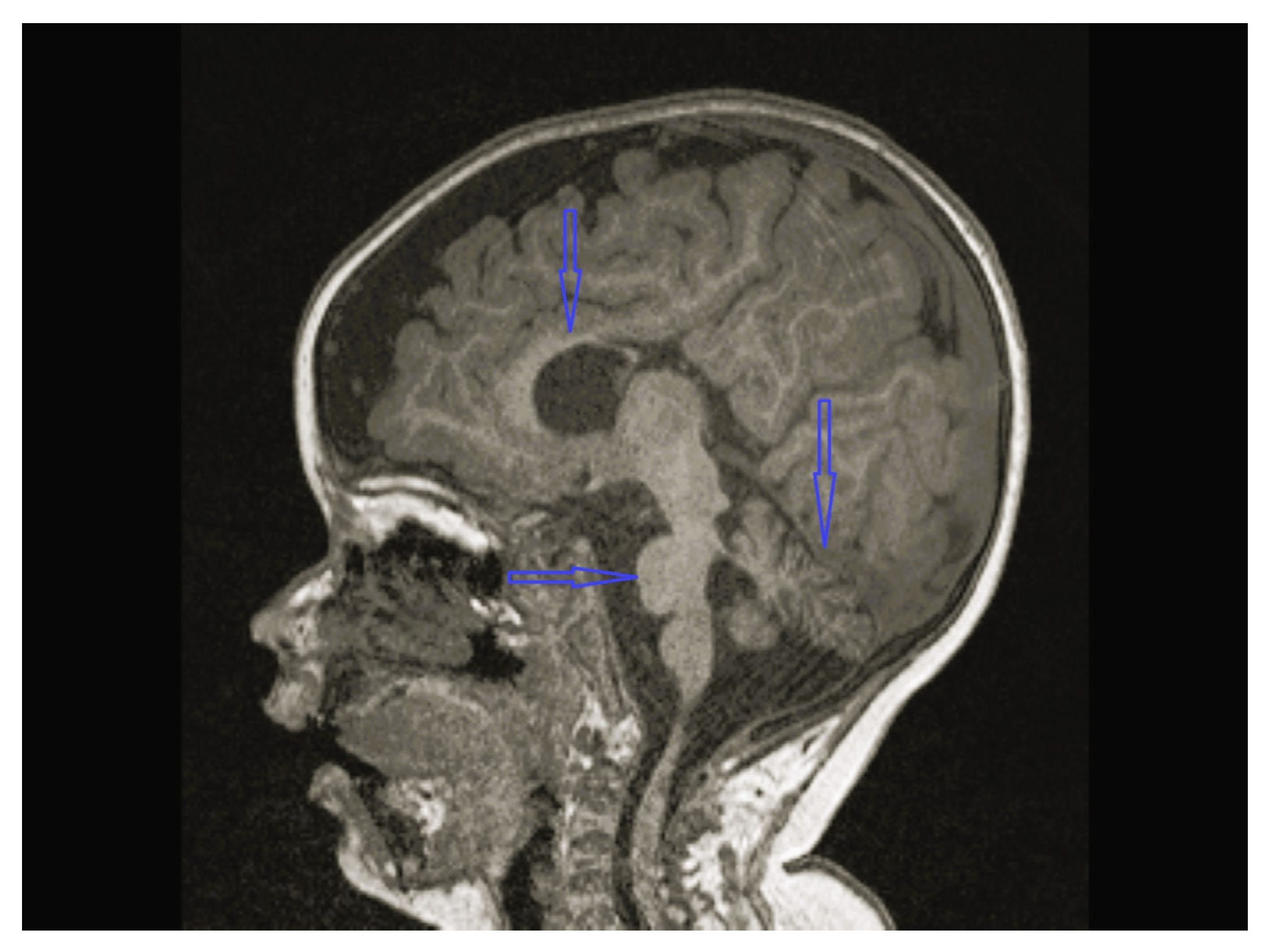 Children 12 01332 g004 Children 12 01332 g004